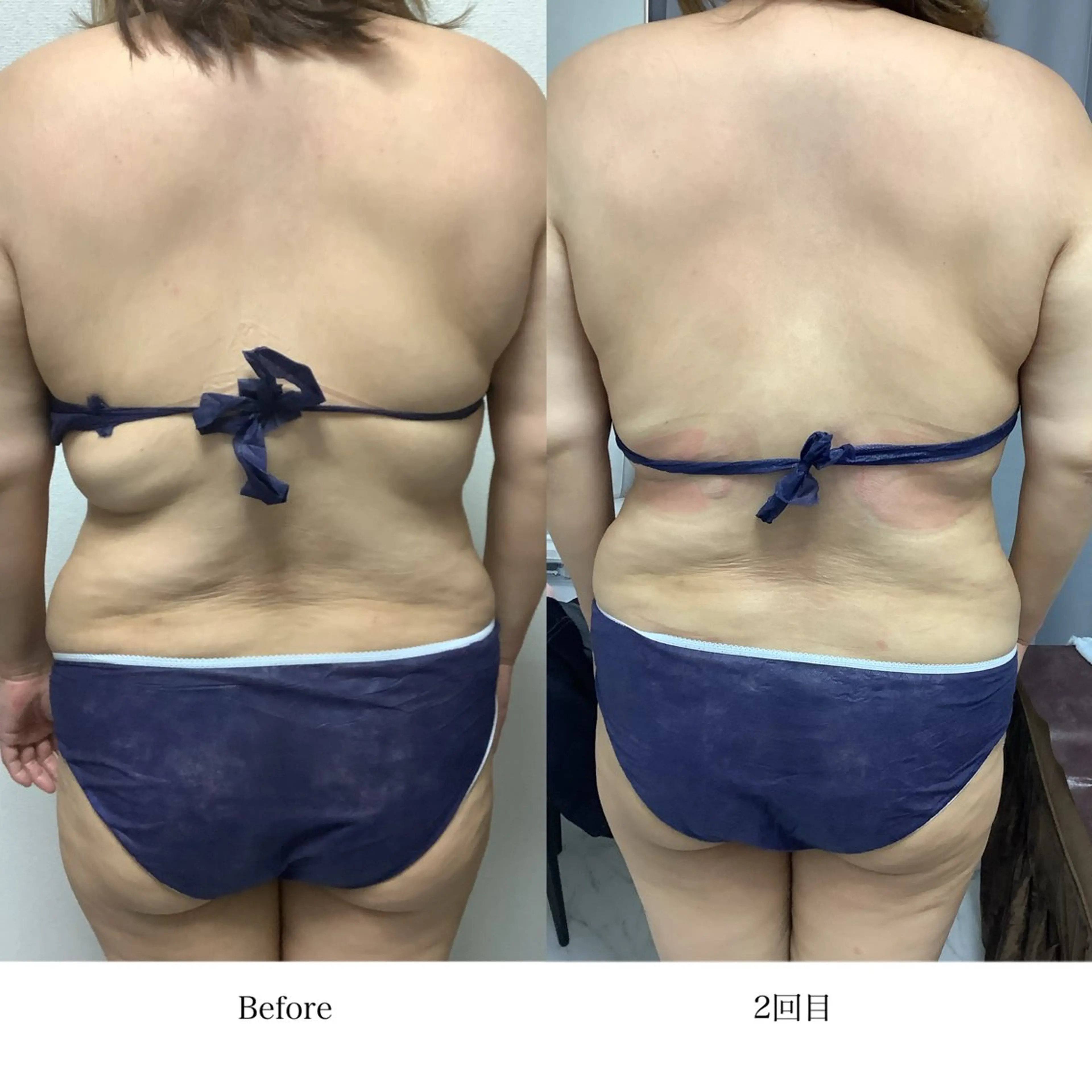 冷却専門店 SLARIのエステ・リラクイメージ