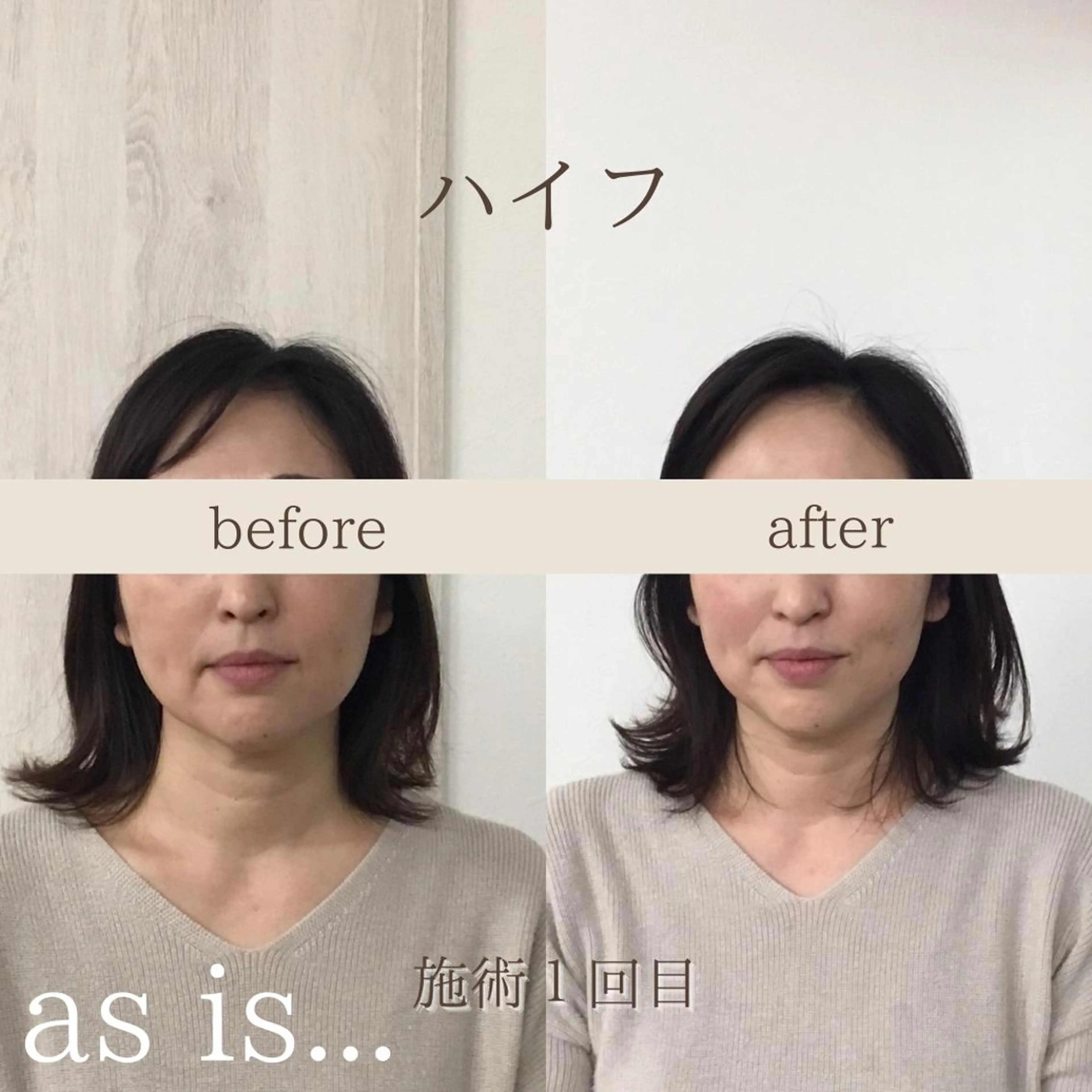 小顔専門アズイズ ビューティー　草津店のエステ・リラクイメージ