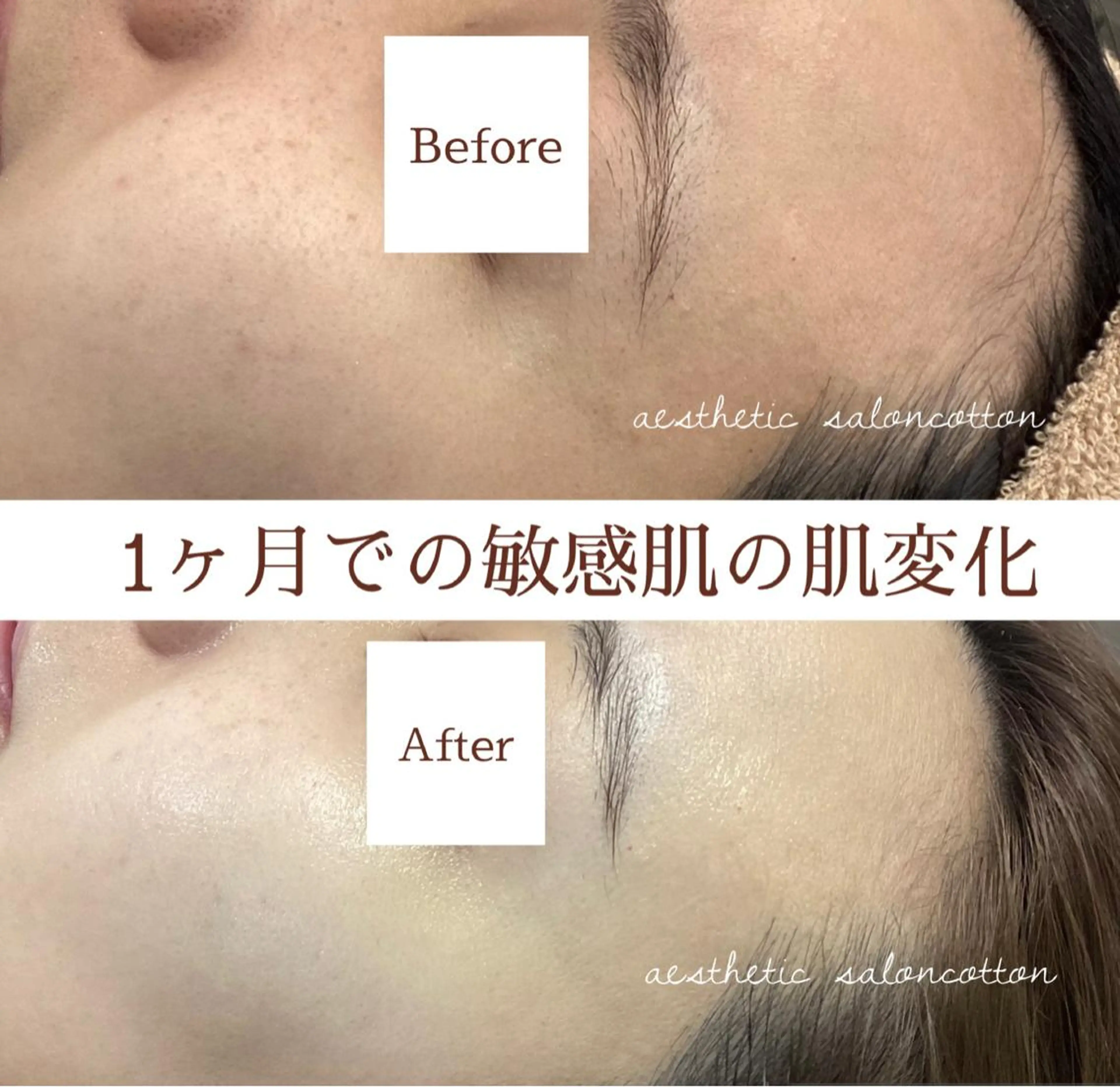 エステ 都度払い 肌質改善専門サロンのエステ・リラクイメージ