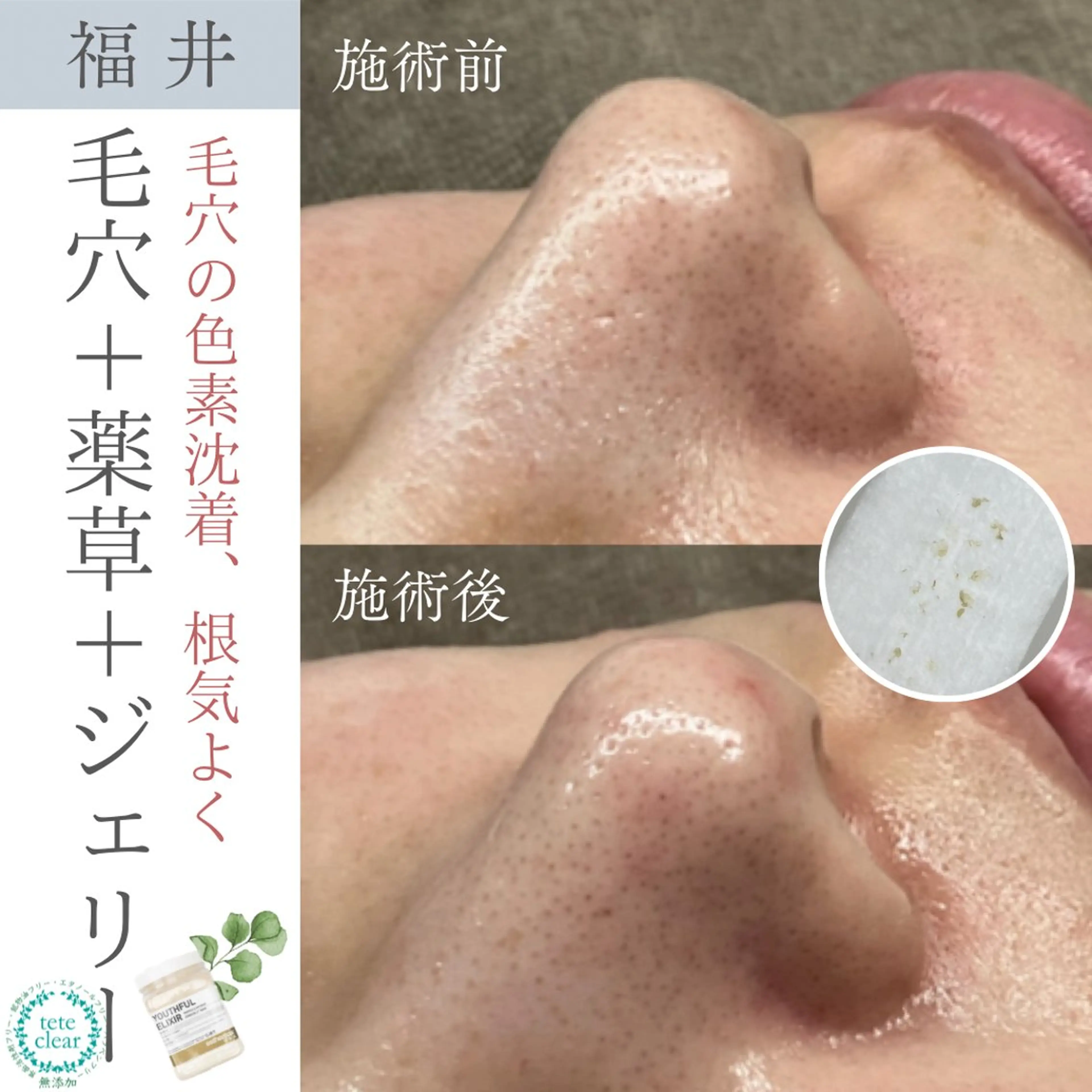 毛穴ケア専門サロン Yourmeユアミーのエステ・リラクイメージ