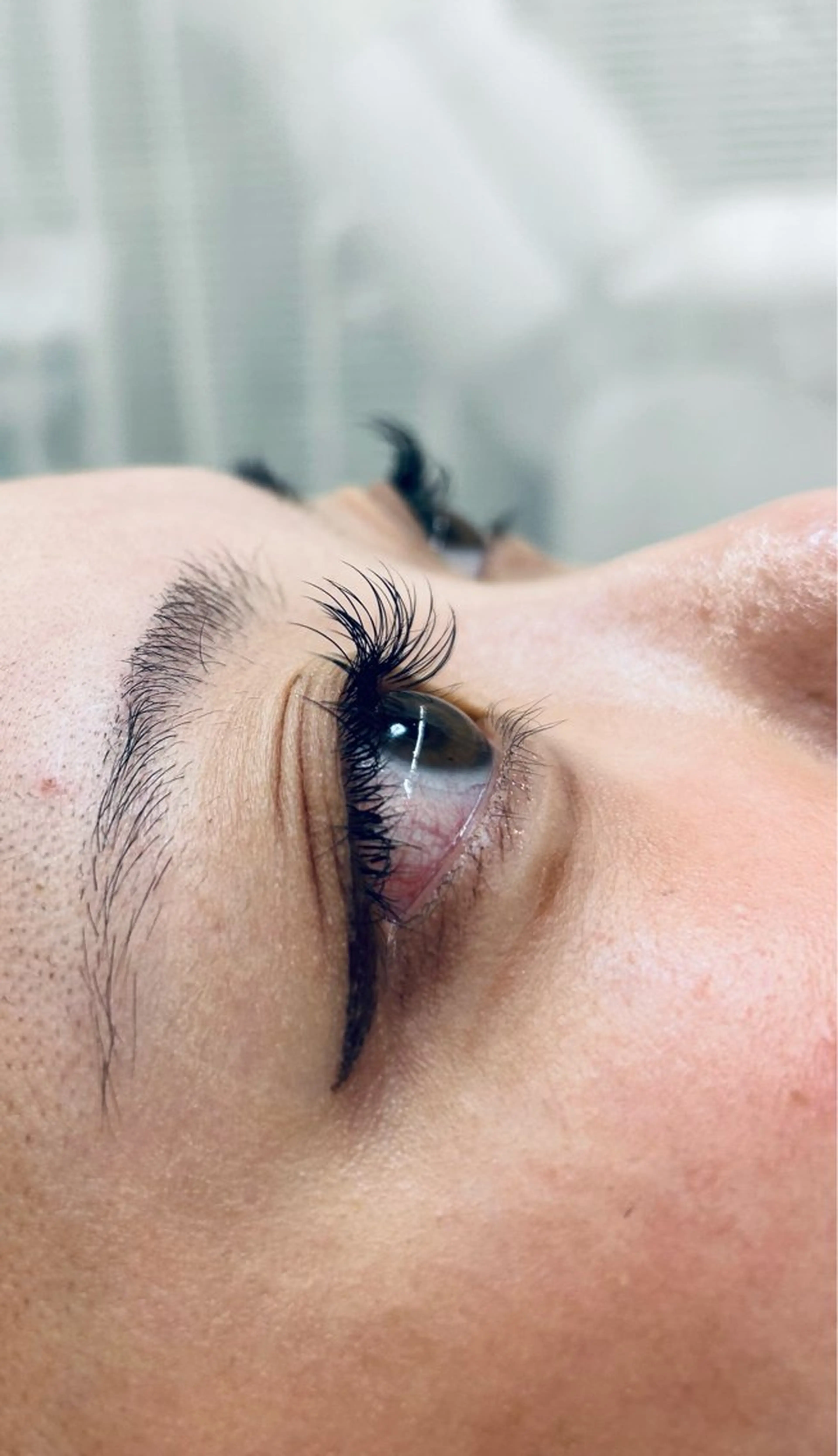 フラットラッシュ140本の写真