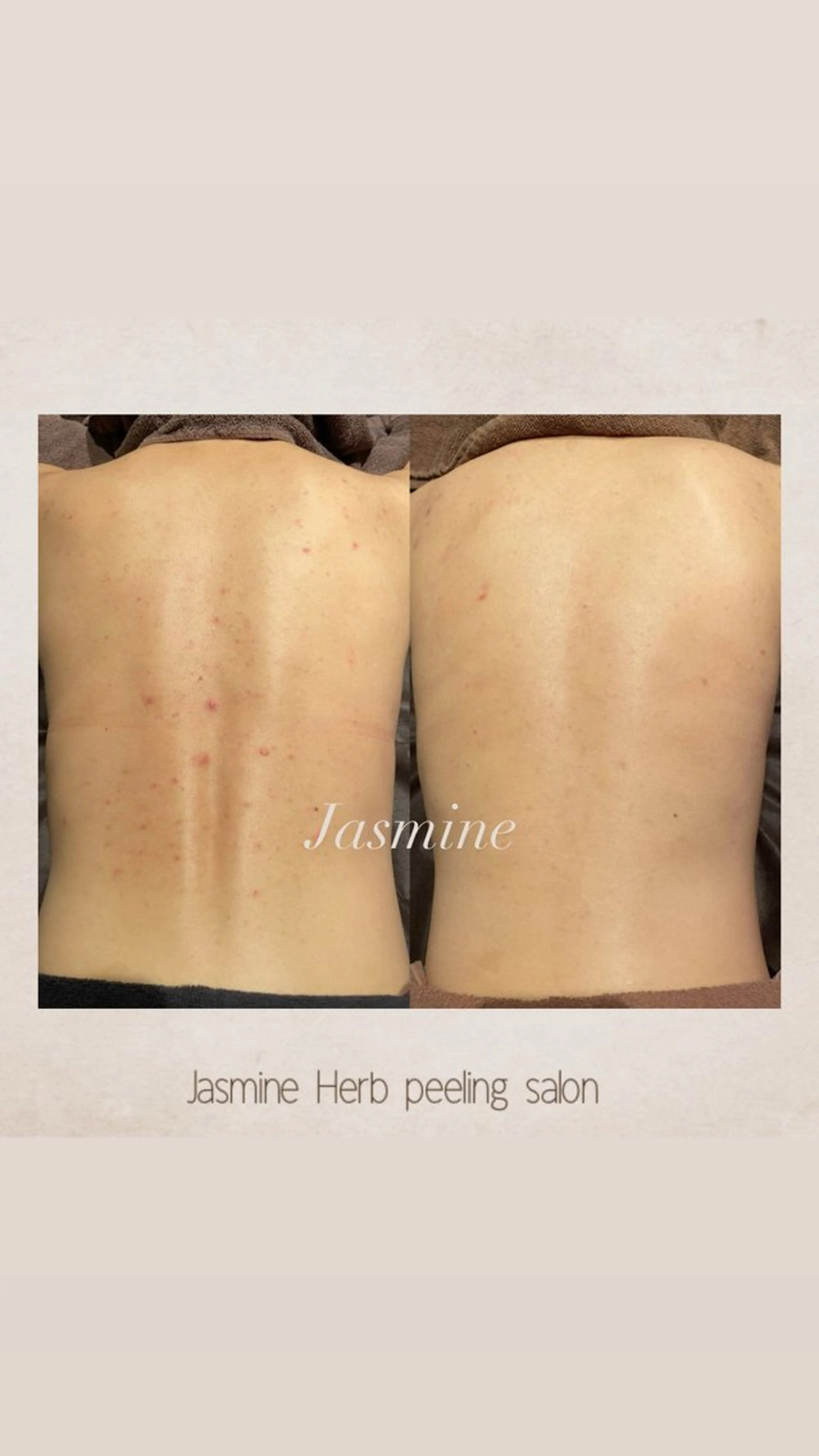エステ Jasmine所属・Jasmine herbのエステ・リラクイメージ