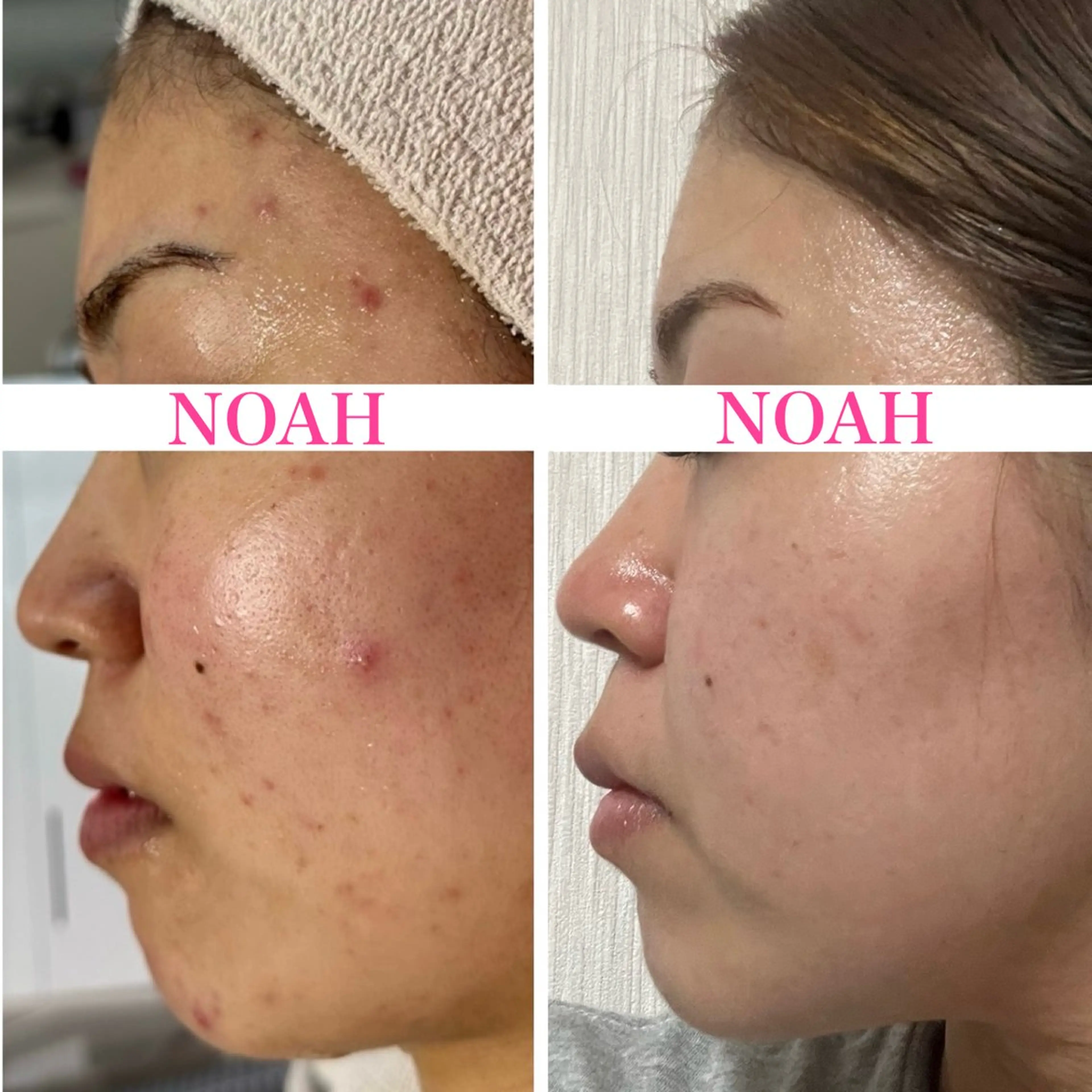 NOAH 小顔毛穴 川越店所属・NOAH ORIEのエステ・リラクイメージ