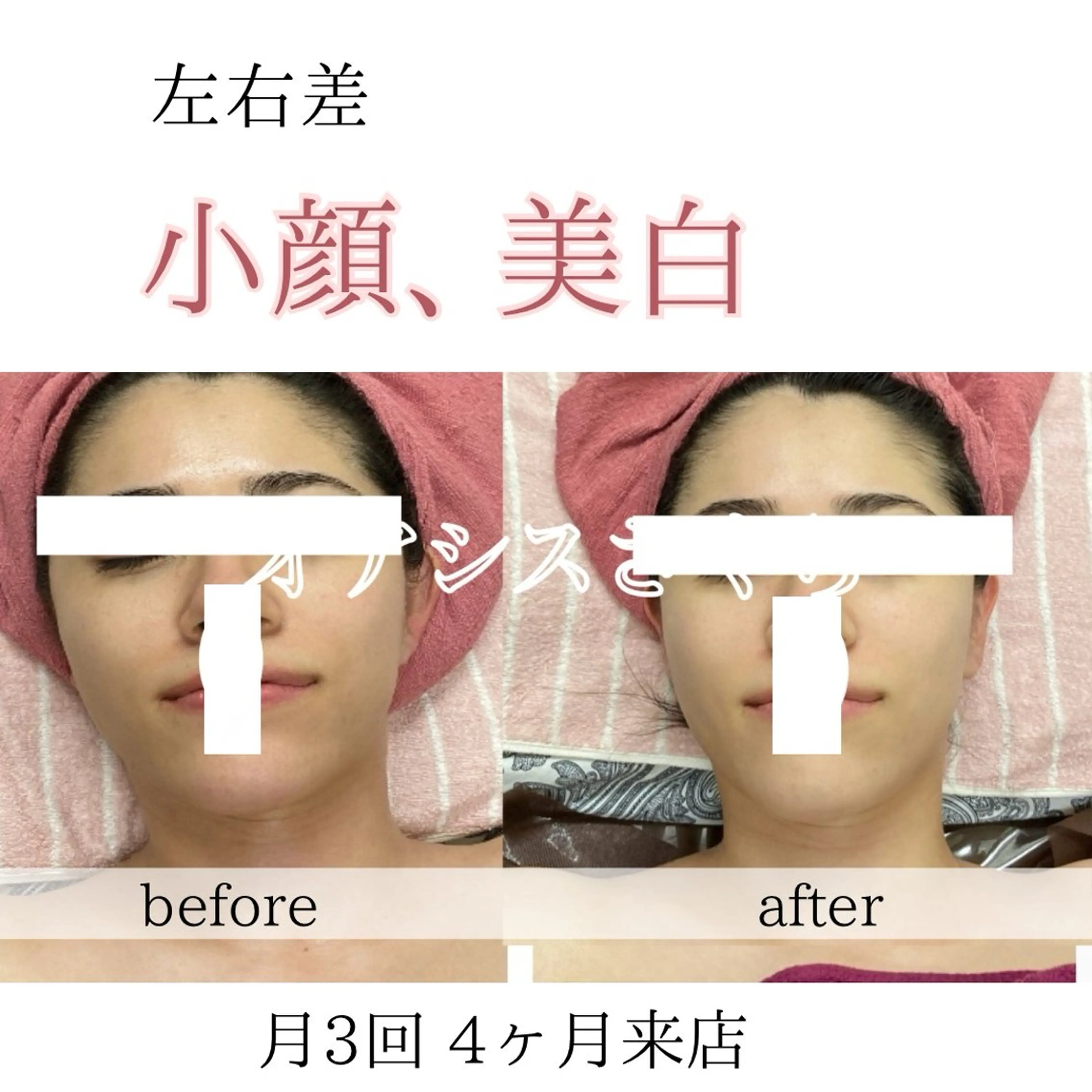 オアシス・さくら所属・自然美人を叶える小顔 と脱毛サロンのエステ・リラクイメージ