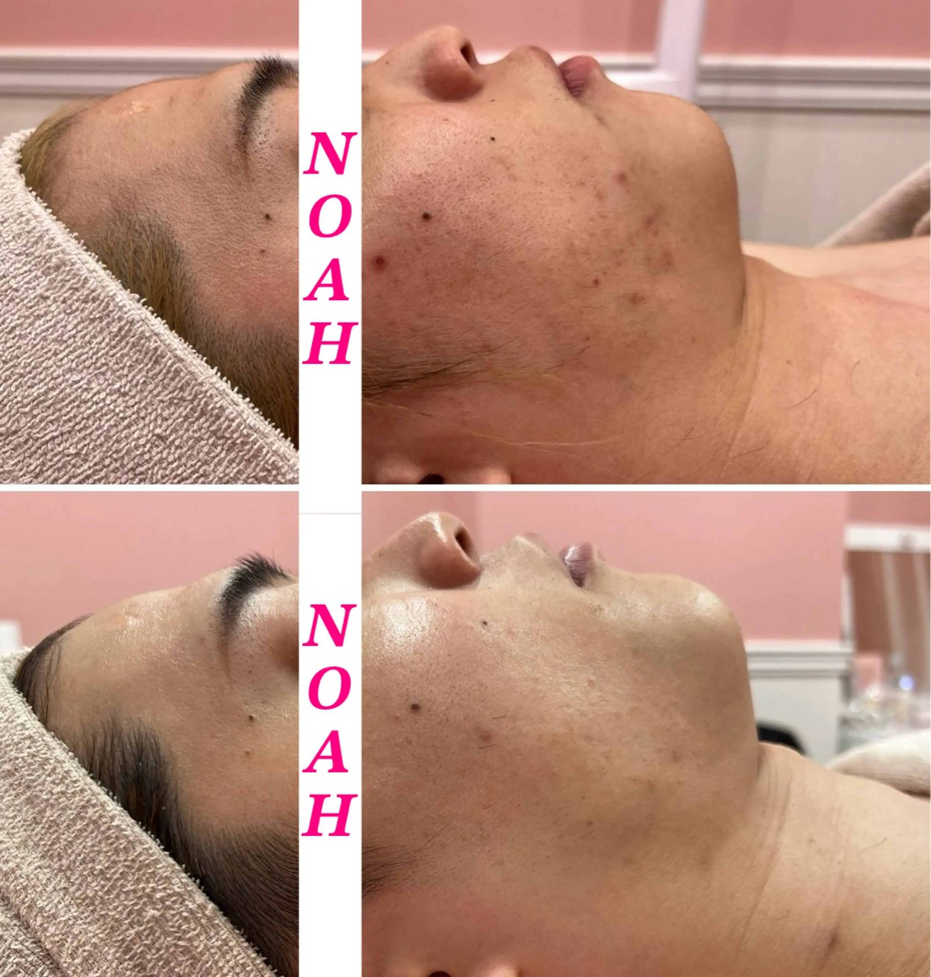 NOAH 小顔毛穴 川越店所属・NOAH ORIEのエステ・リラクイメージ