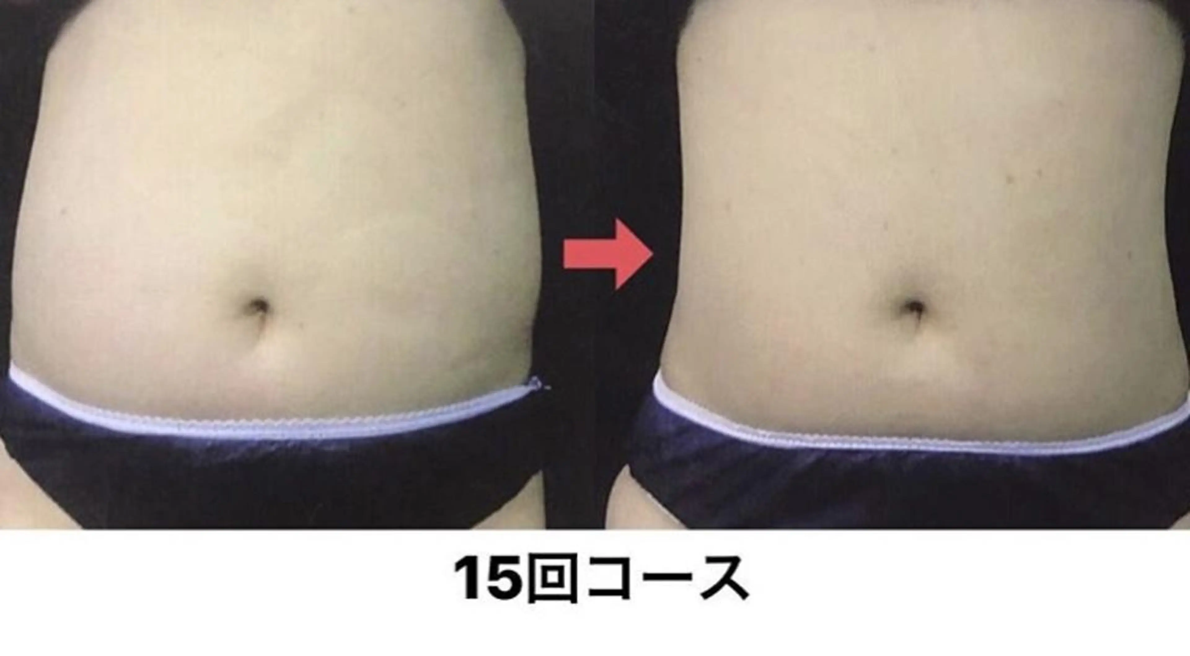 横浜エステサロン R-ing リングのエステ・リラクイメージ