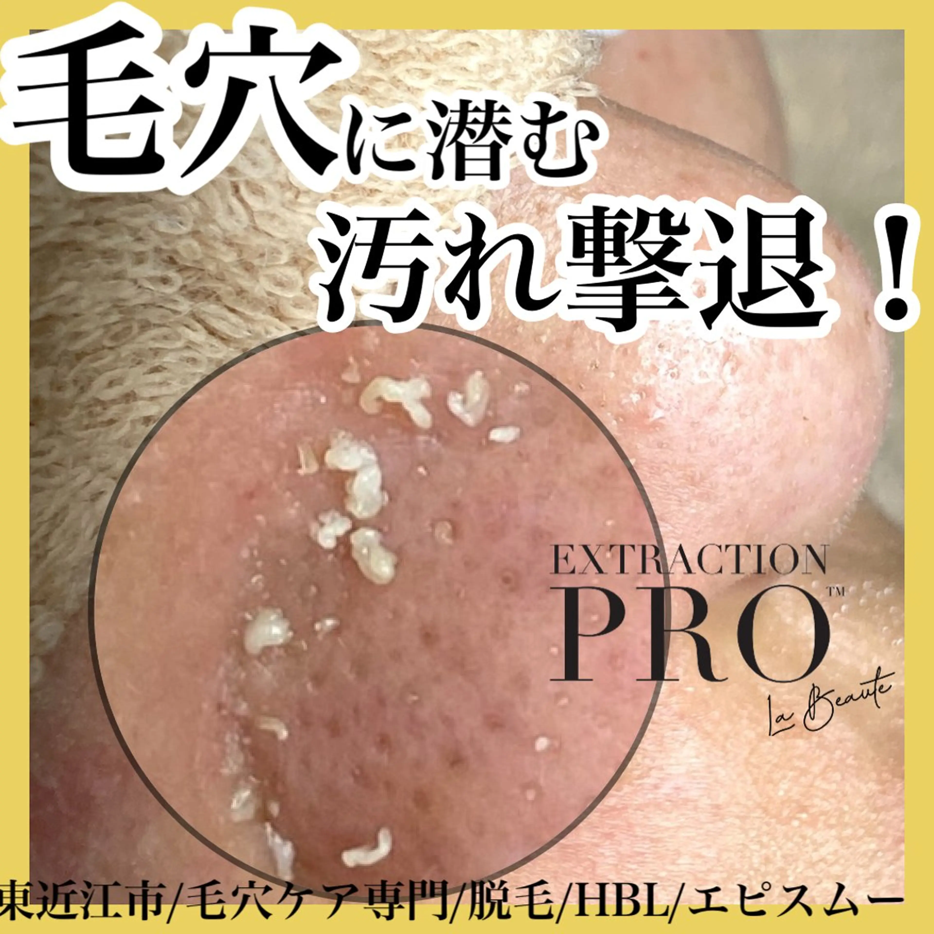 epismoo 脱毛/HBL/毛穴の眉毛・アイブロウイメージ