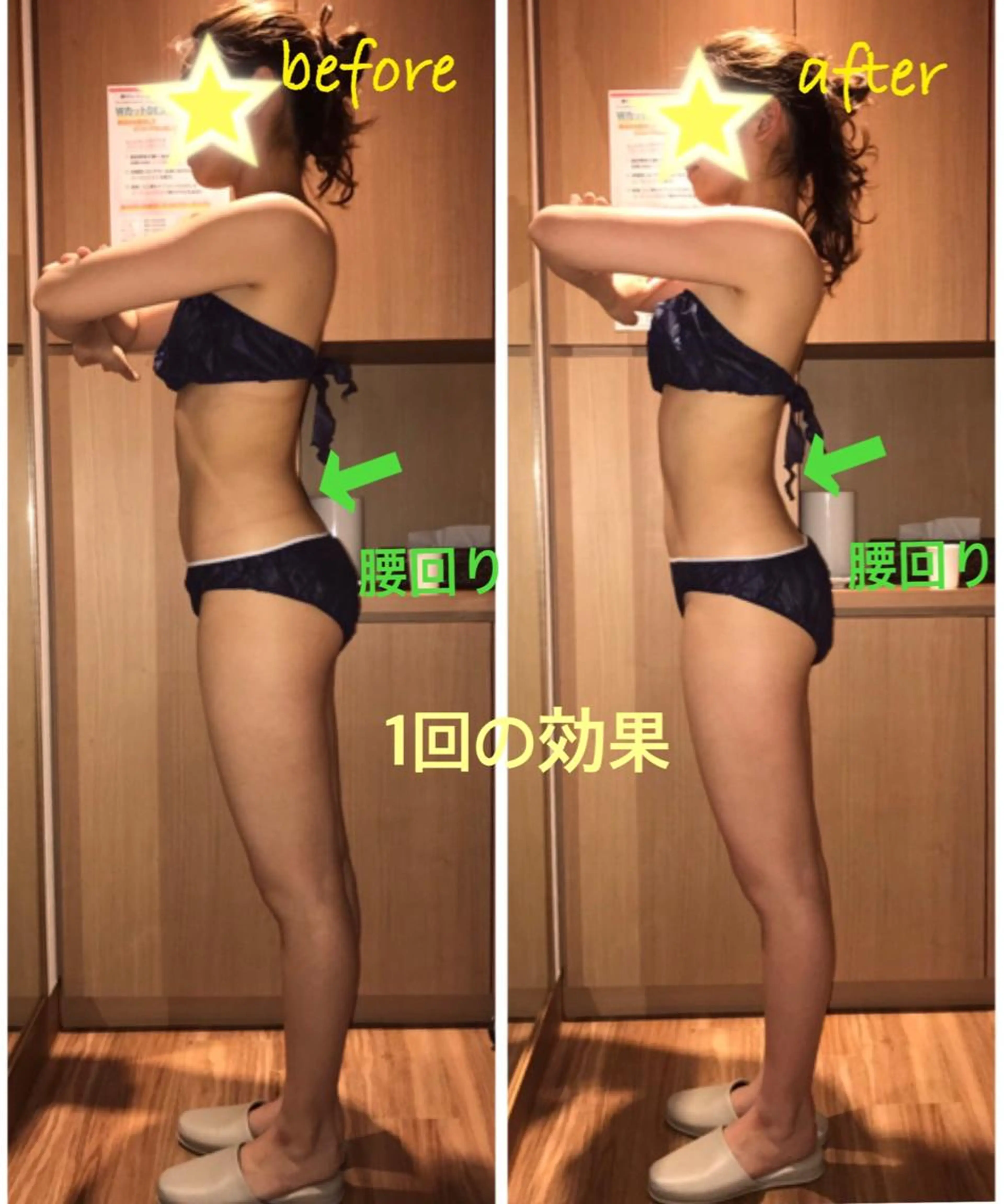 【医療レベル】1回で実感！人気ボディケア！！①お腹&反り腰②足痩せ&ヒップアップ　　どちらか選べます！の写真