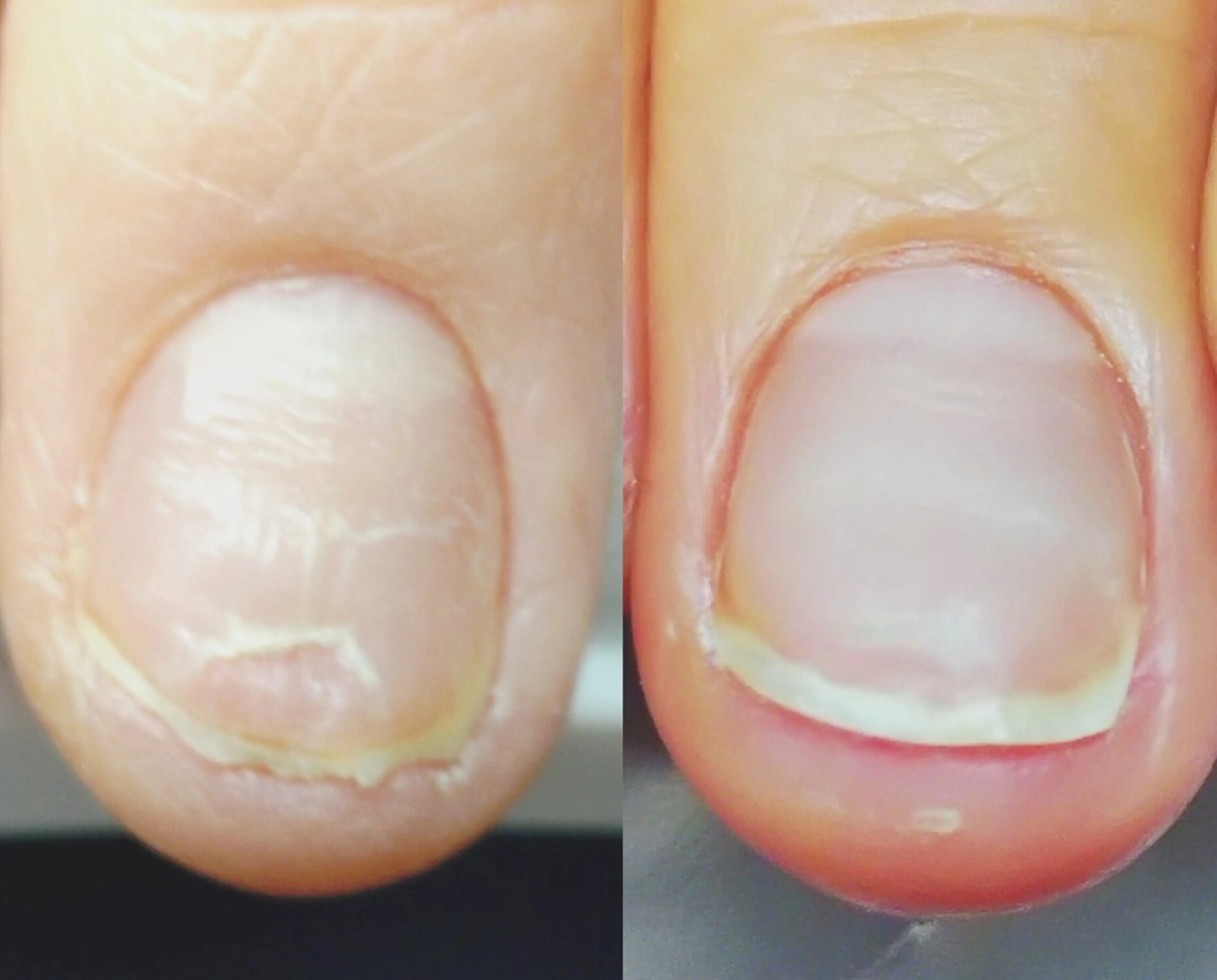 ネイル 野島 亜美のネイルデザイン