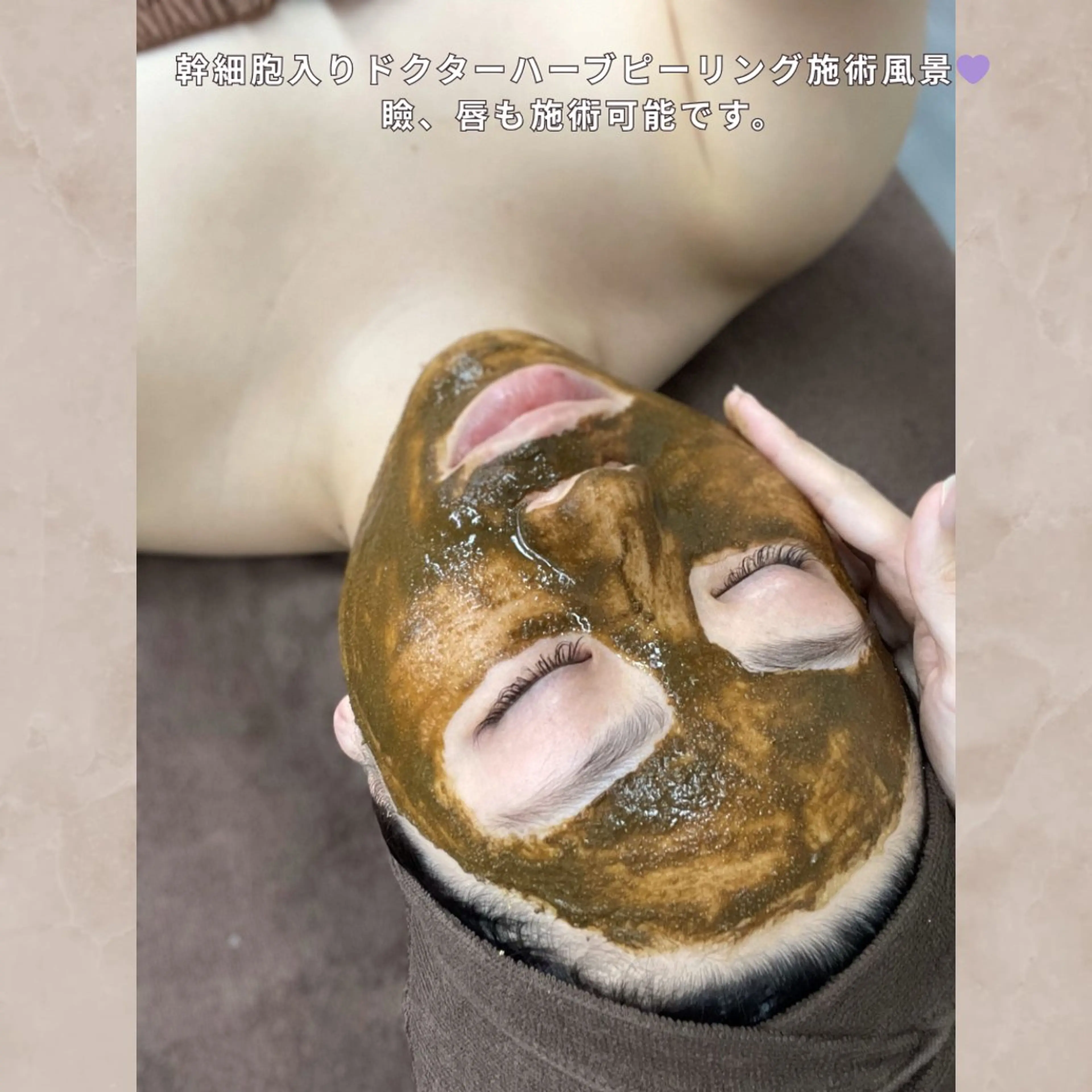 エステ ハーブピーリング専門店YOOTOX所属・大橋 唯のエステ・リラクイメージ