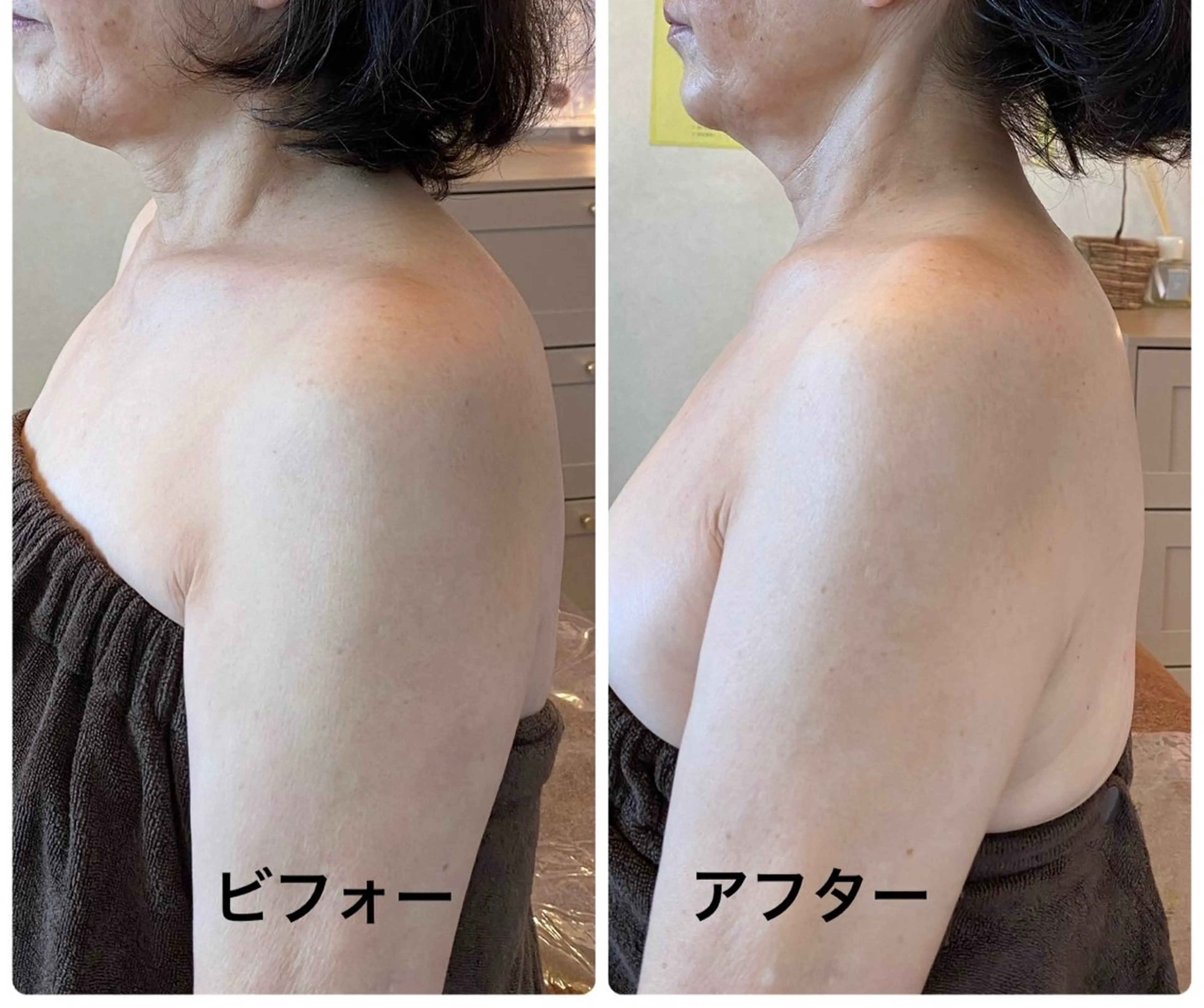 美zen筋骨小顔トリートメント⏰15時までのお時間限定価格の写真