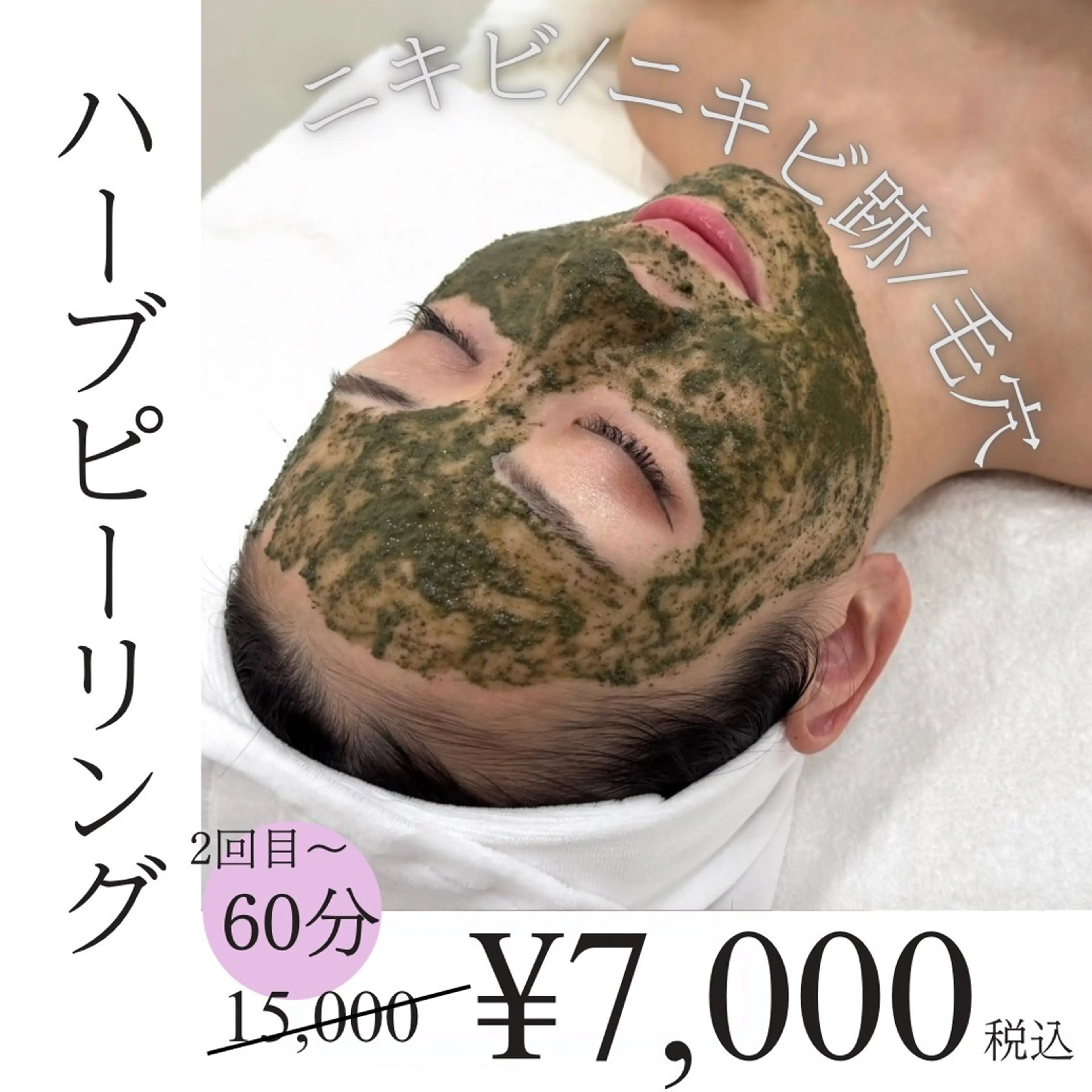 REVIハーブピーリング2回目🌿の写真