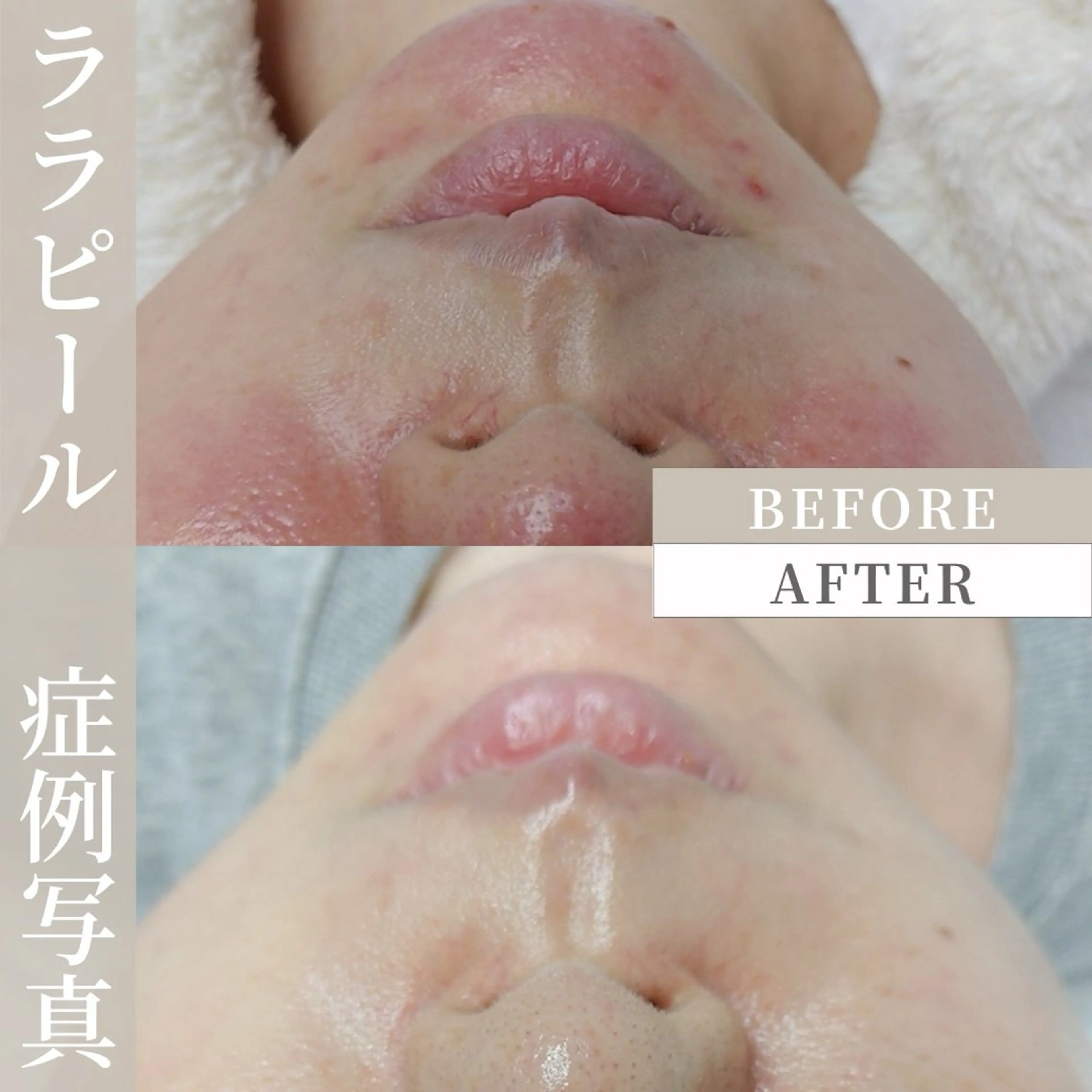 Liam《美肌管理/ 3D小顔/脂肪ケア》のその他イメージ