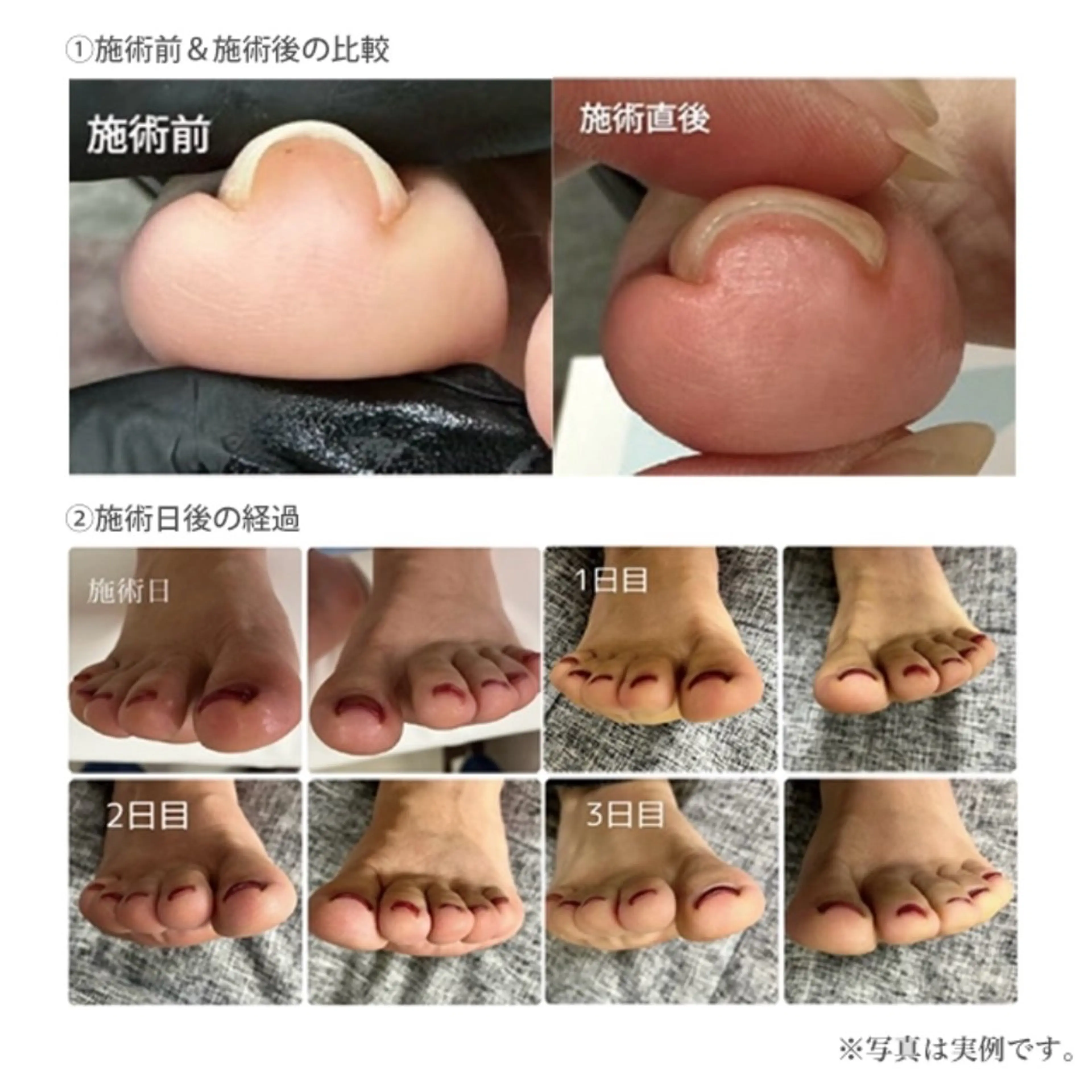 ネイル フットネイル FOI NAILのネイルデザイン