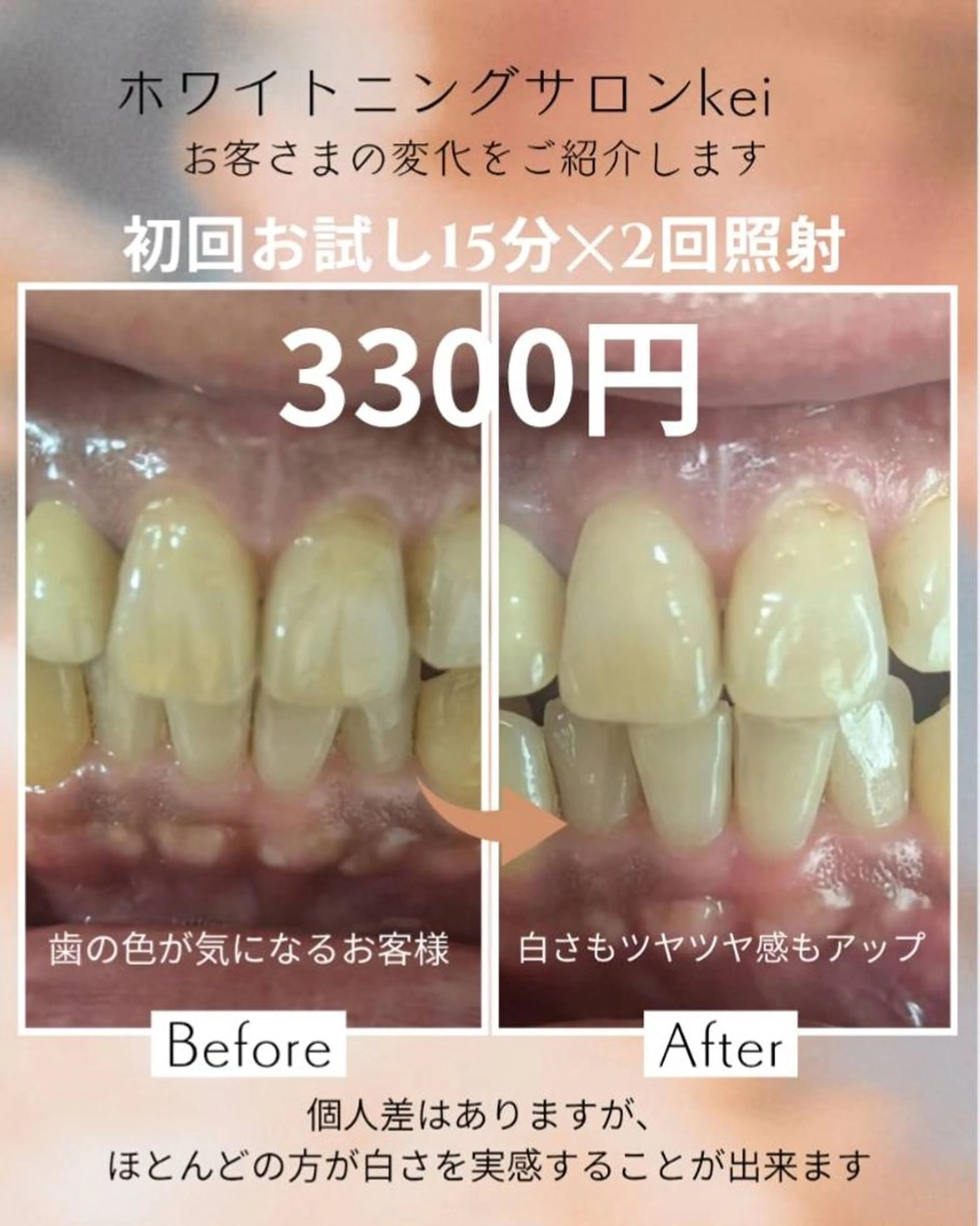 ホワイトニングサロン keiのその他イメージ