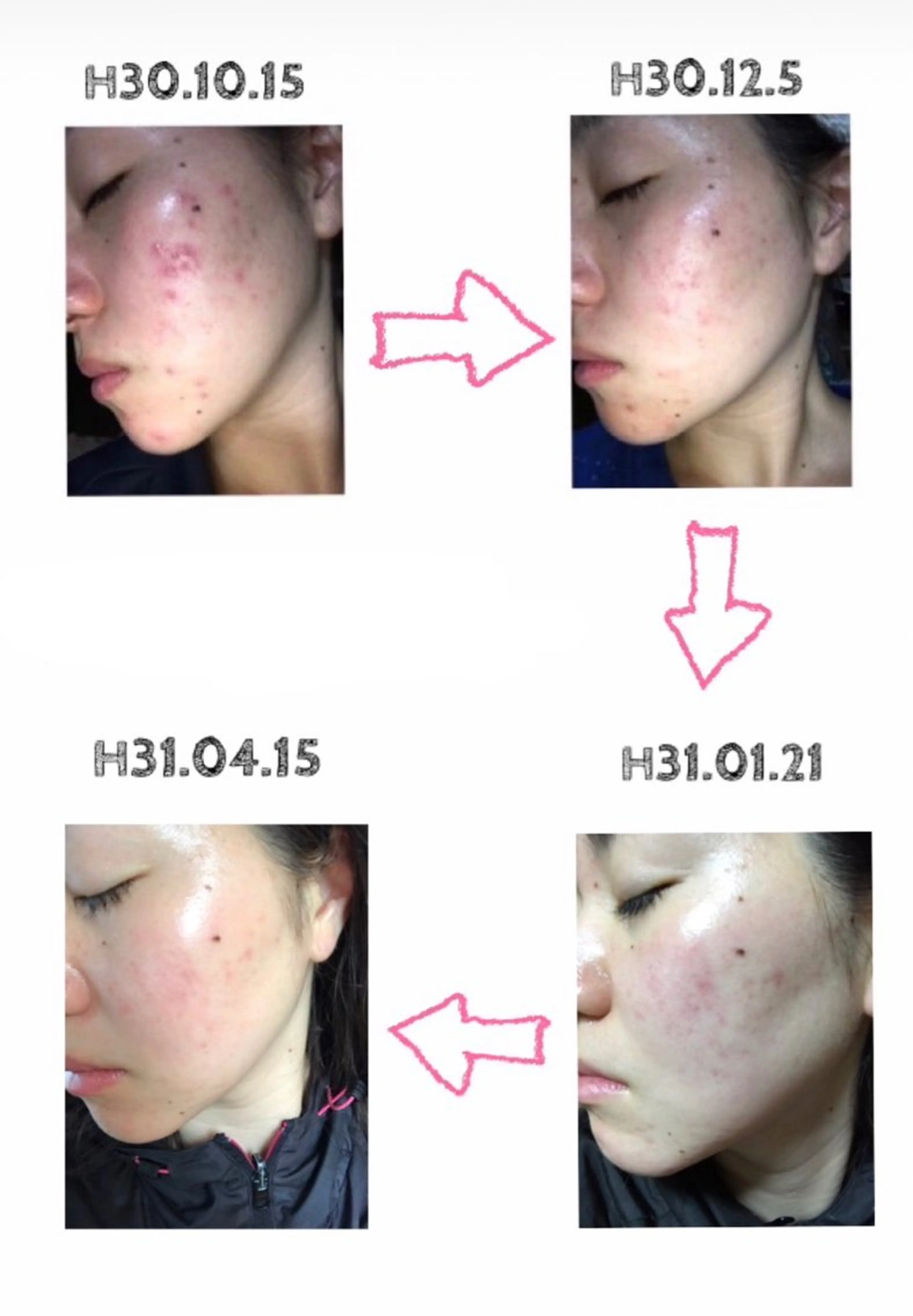 肌質改善サロン🌕 ⠀【ルーナピエナ】のエステ・リラクイメージ