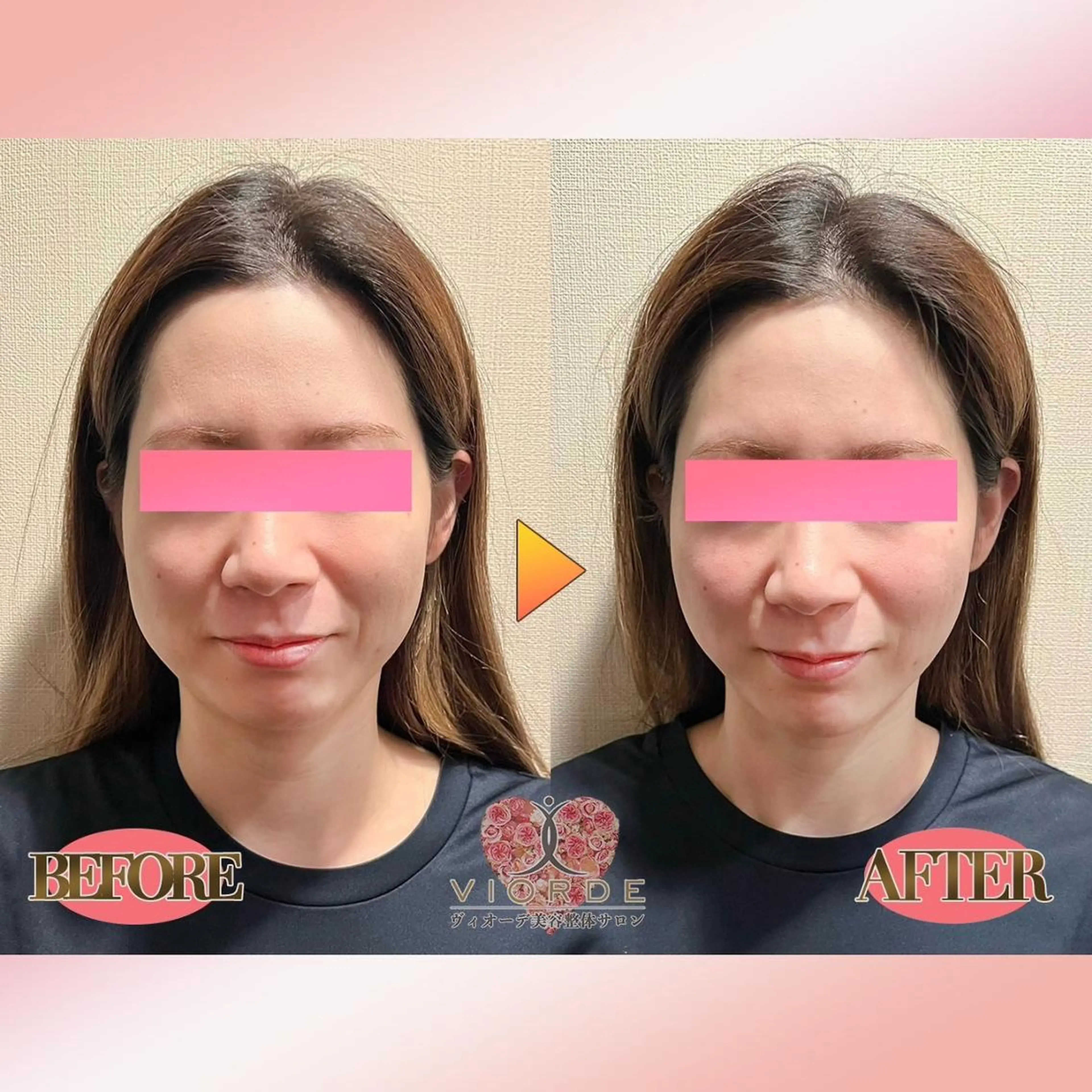 リラク ヴィオーデ美容整体 サロン 恵比寿店のエステ・リラクイメージ