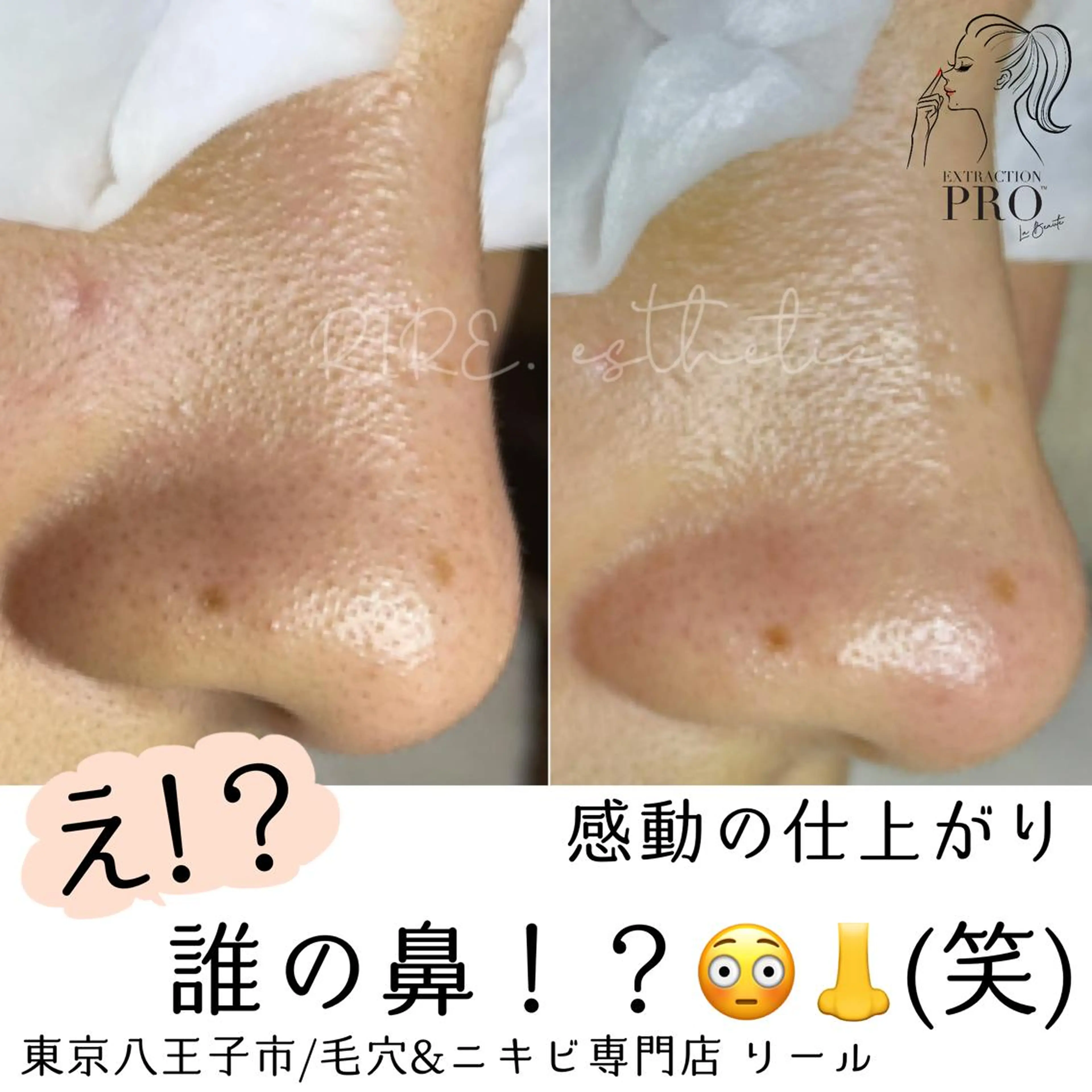 毛穴肌育専門店 リールのエステ・リラクイメージ