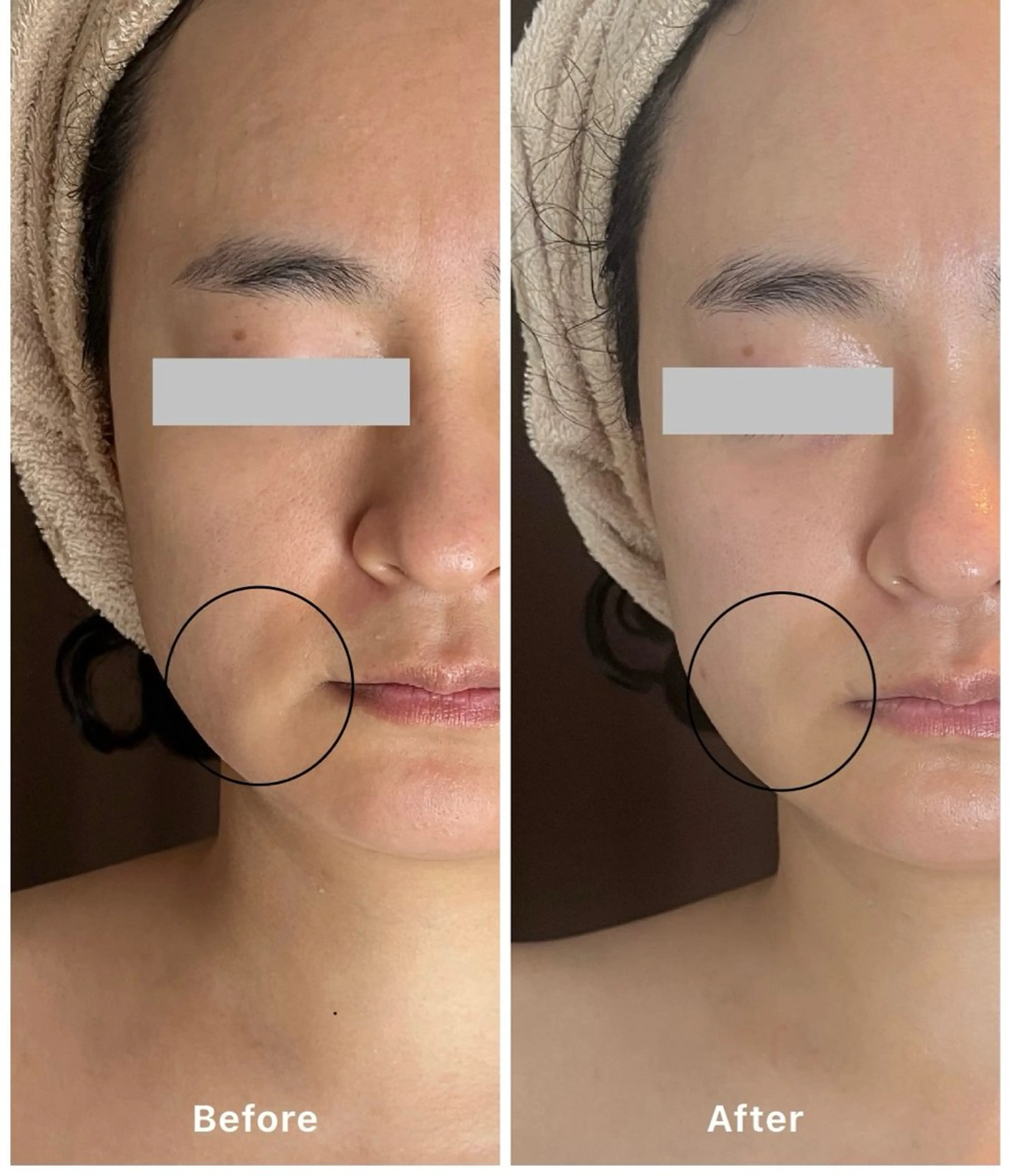 エステ エステサロン Libertaのその他イメージ