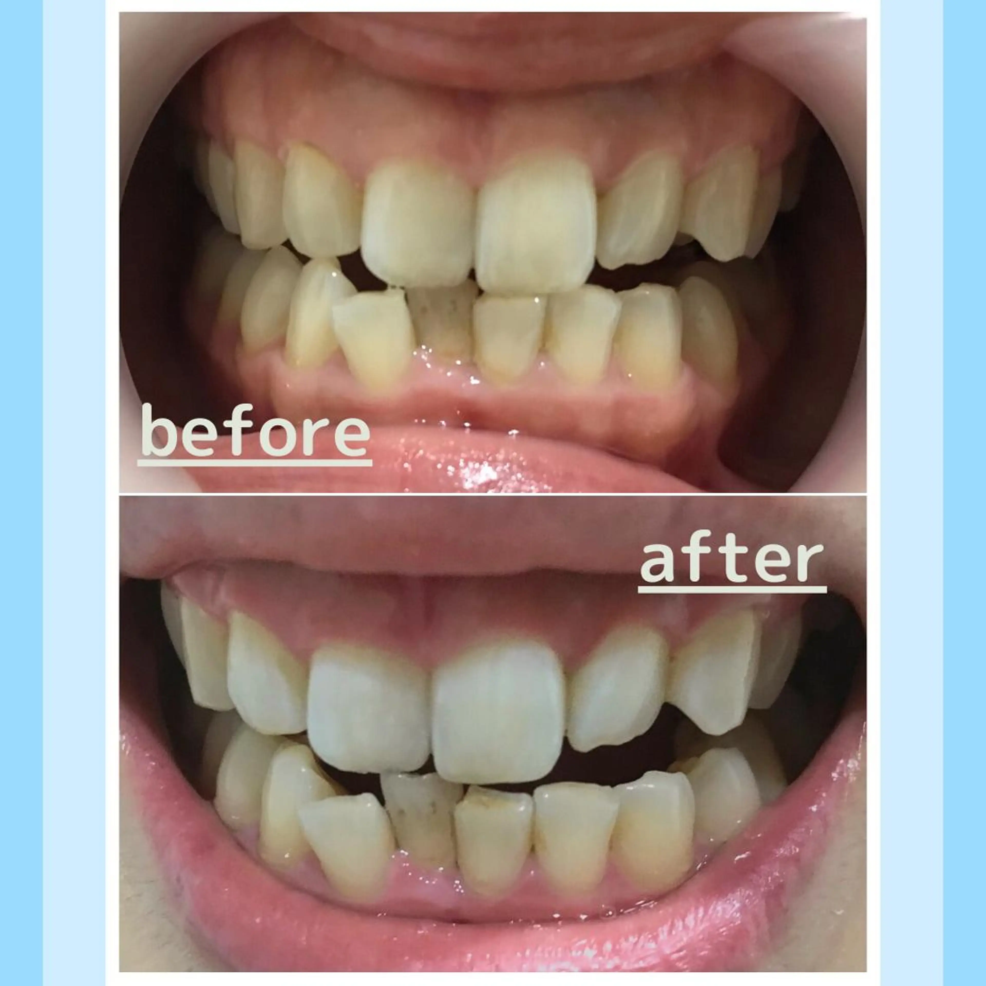 メンズ クリスマス お手軽ホワイトニングsalon mina所属・武元 奈津美のその他イメージ