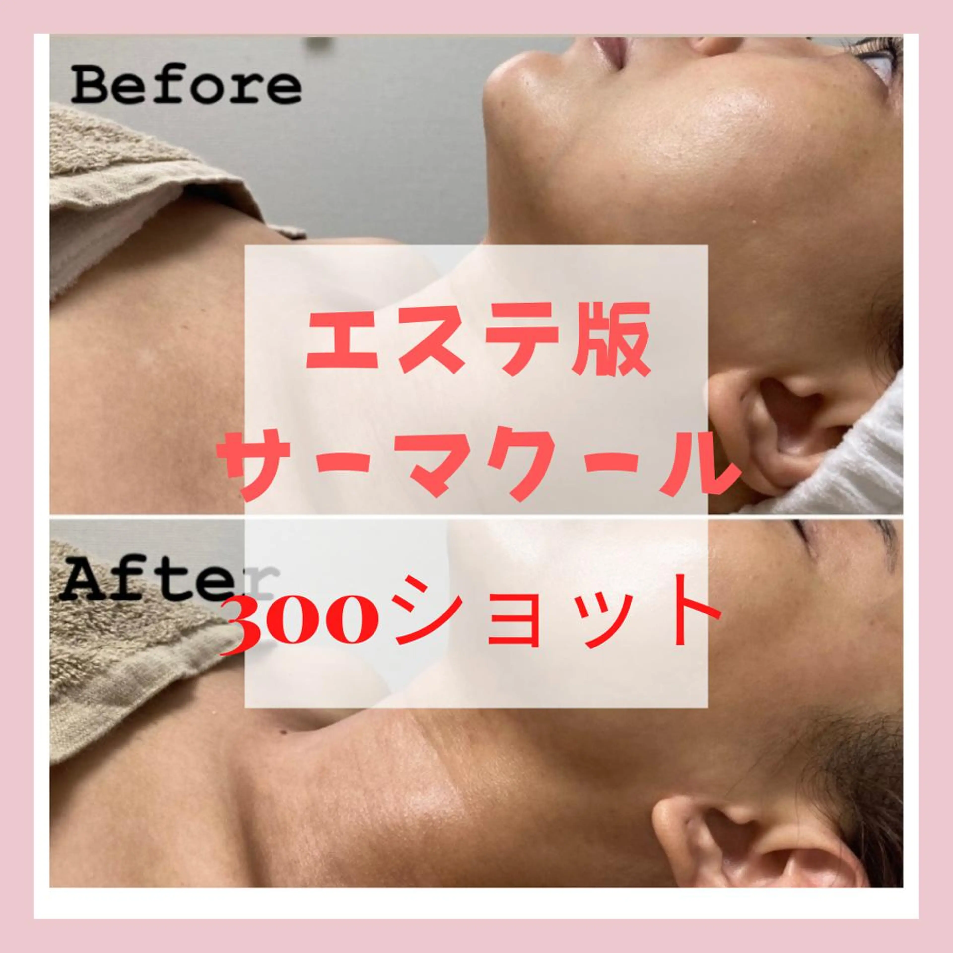 カラー パーマ ヘアアレンジ メンズ マツエク・マツパ 毛穴，ニキビ跡 改善総合サロンのその他イメージ