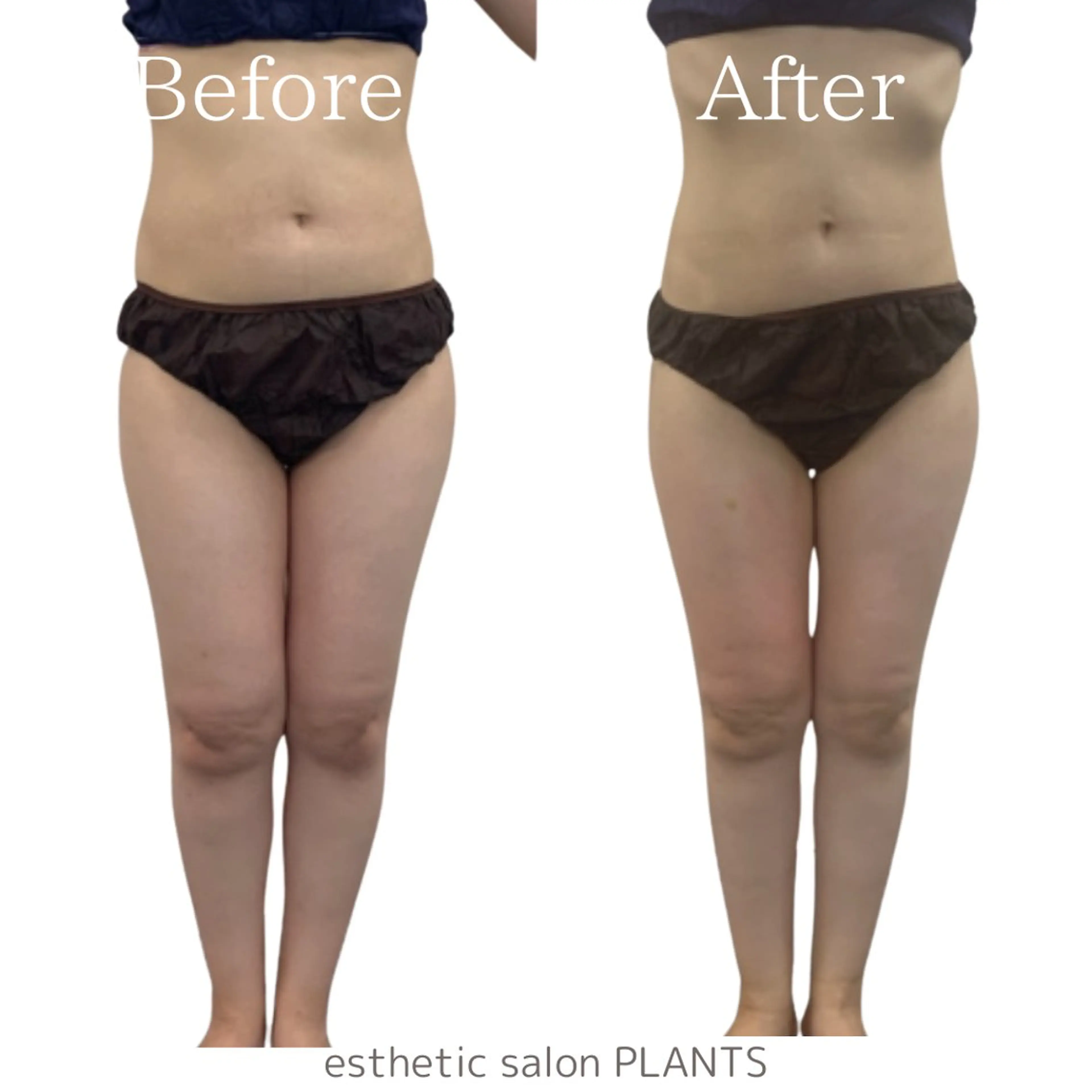 エステ esthetic salon PLANTS所属・エステティックサロン PLANTSのエステ・リラクイメージ