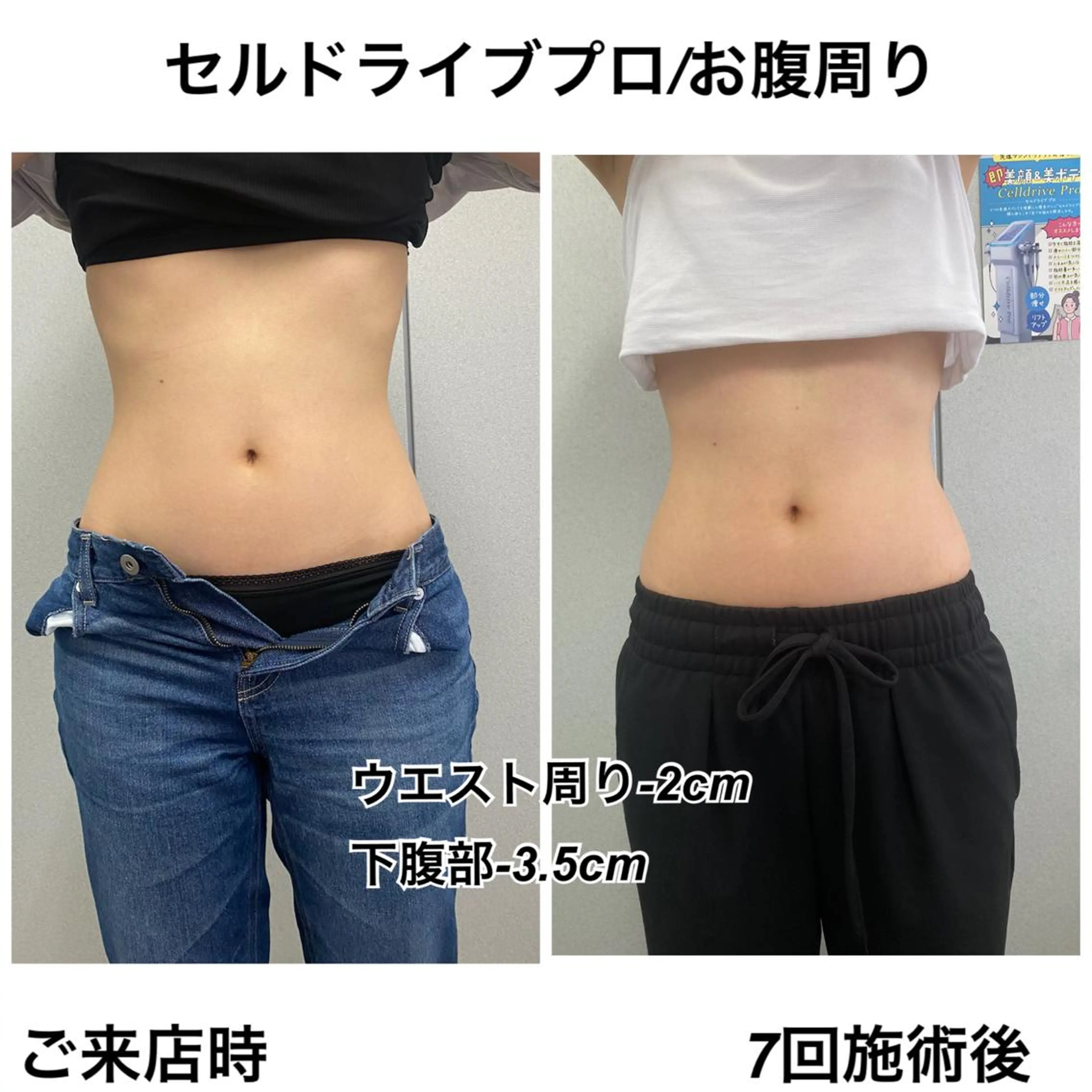 Venus所属・エステサロン Venusのエステ・リラクイメージ