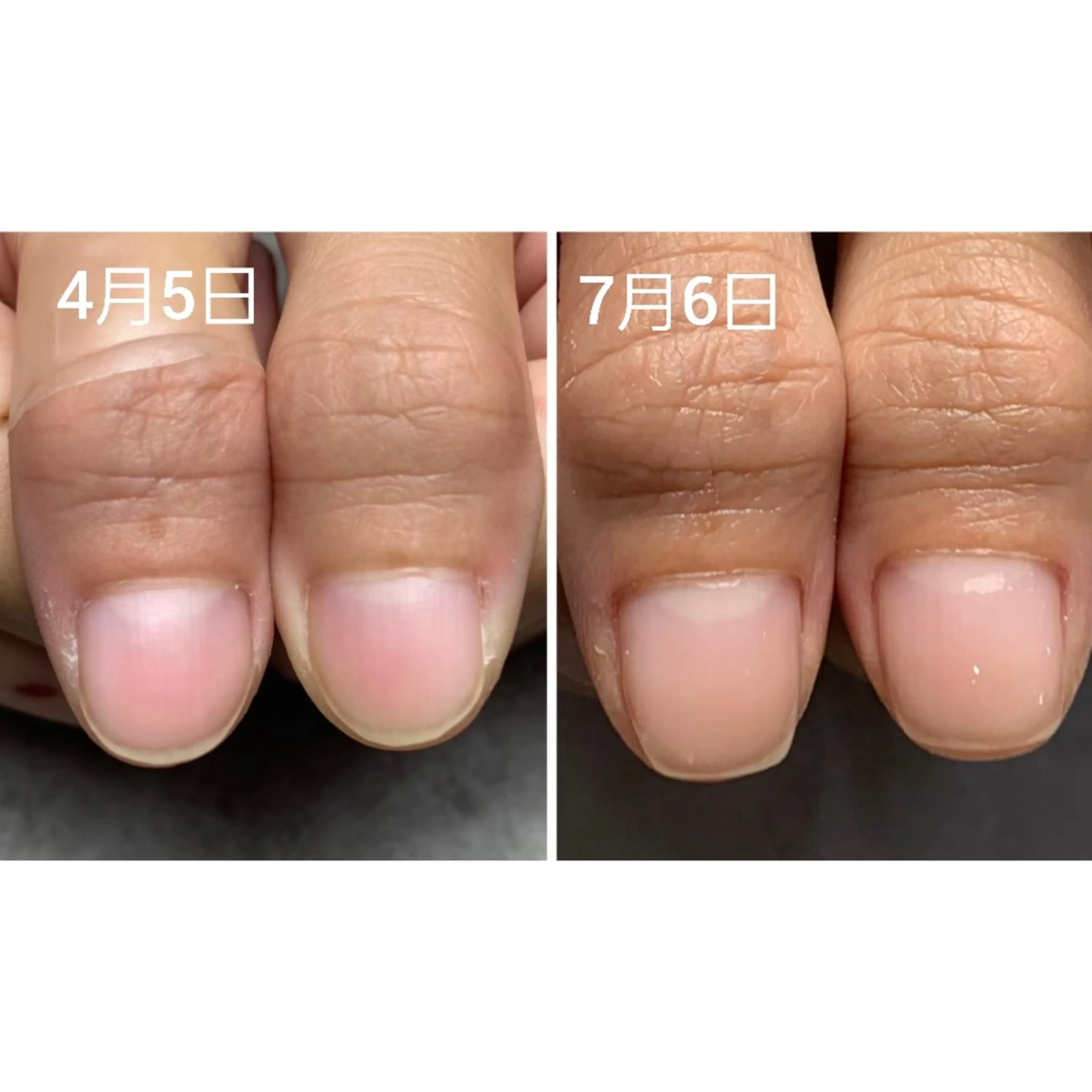 ネイル ジェルネイル ハンドケア AKT NAIL所属・AKT Beauty ドライヘッドスパのネイルデザイン