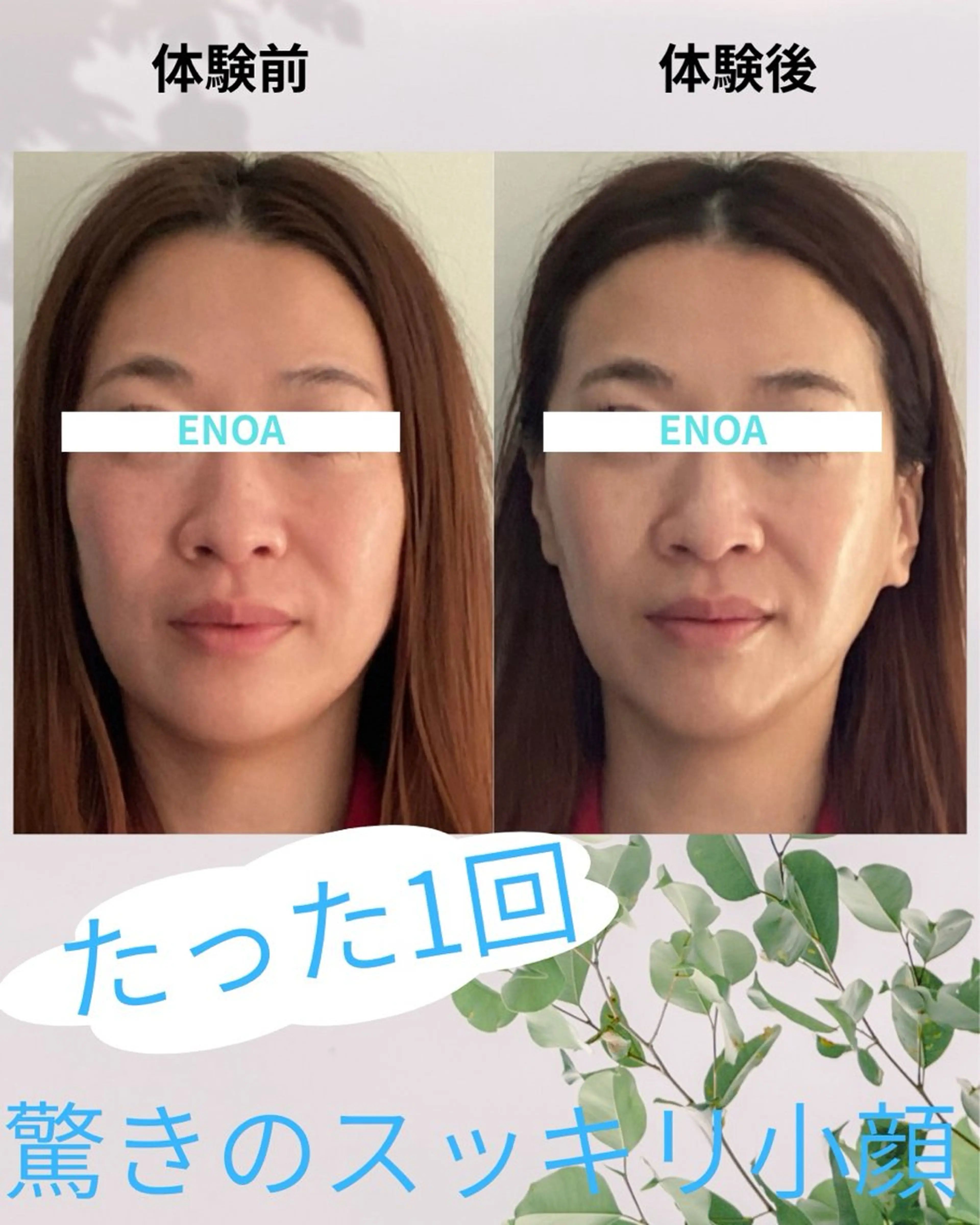 人気No. 1✨輪郭矯正コルギ60分【小顔/たるみ/肩首こり/目の疲れ/巻肩に◎⠀】の写真