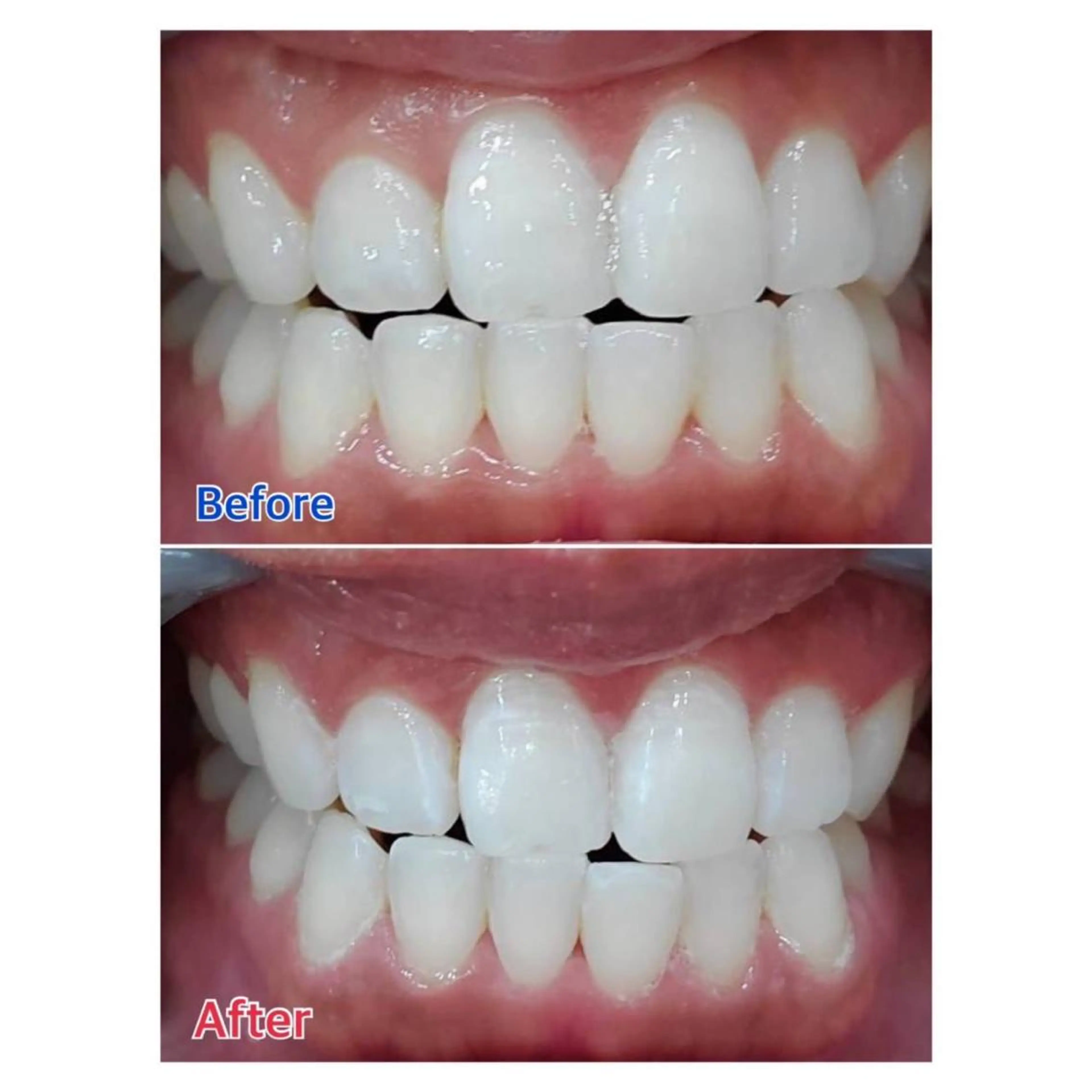 MBEAUTYSALON 千葉店・京成大久保所属・Melty 輝のその他イメージ