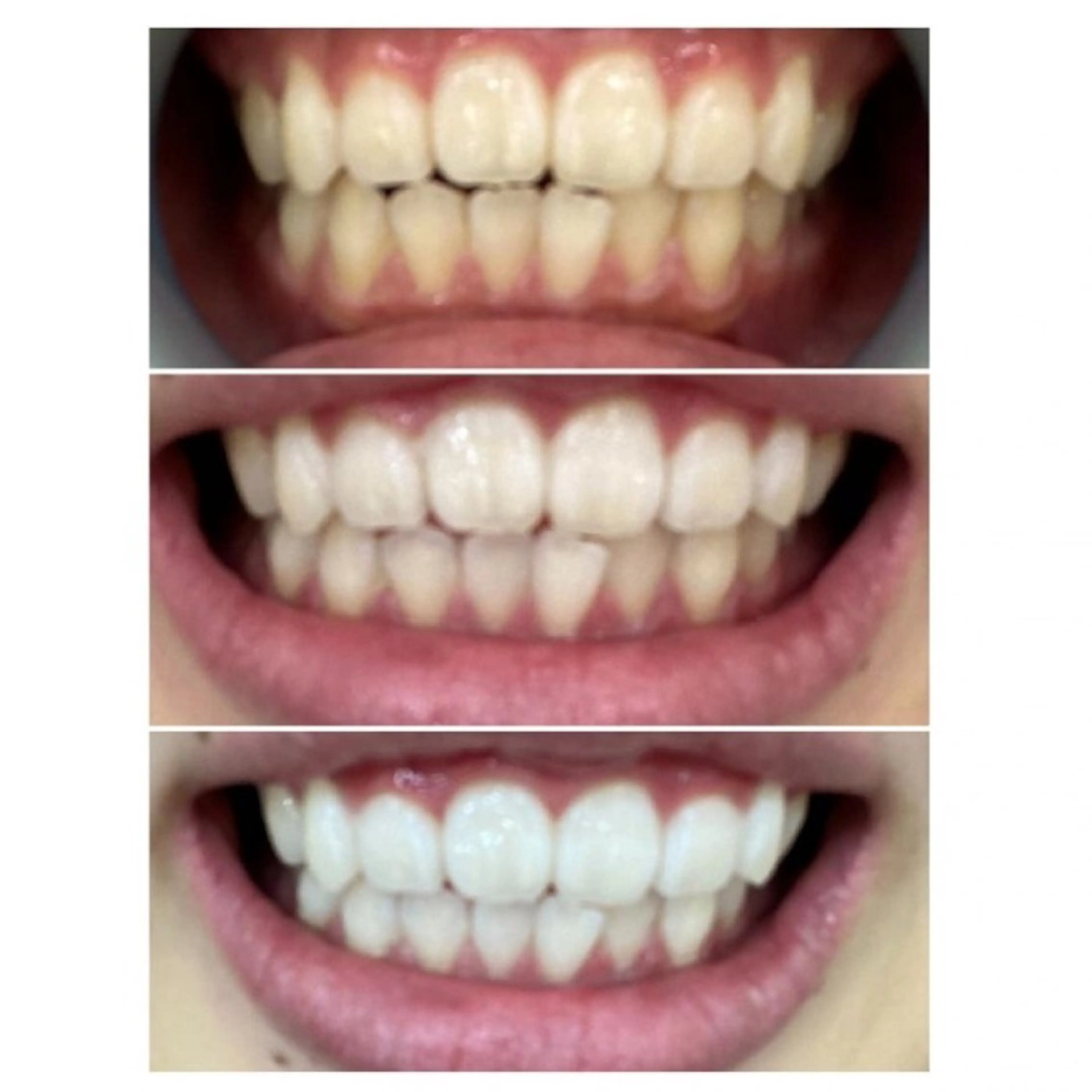 M渋谷店所属・Ｍ渋谷 ホワイトニングのエステ・リラクイメージ