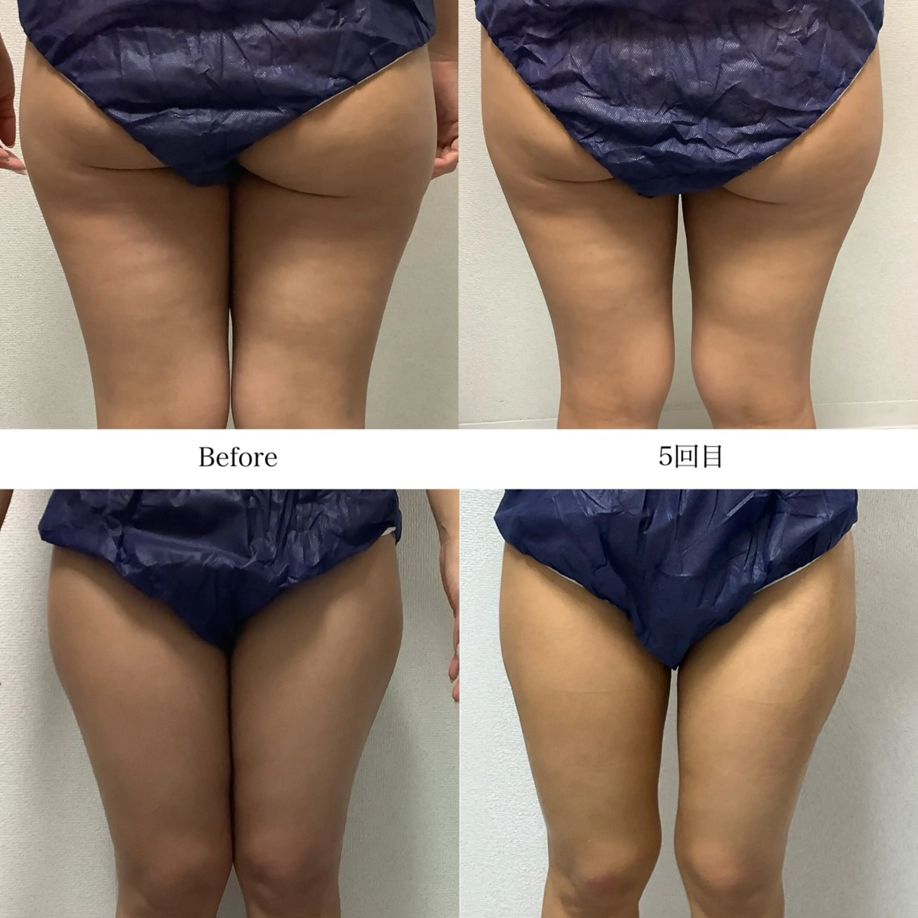 冷却専門店 SLARIのエステ・リラクイメージ