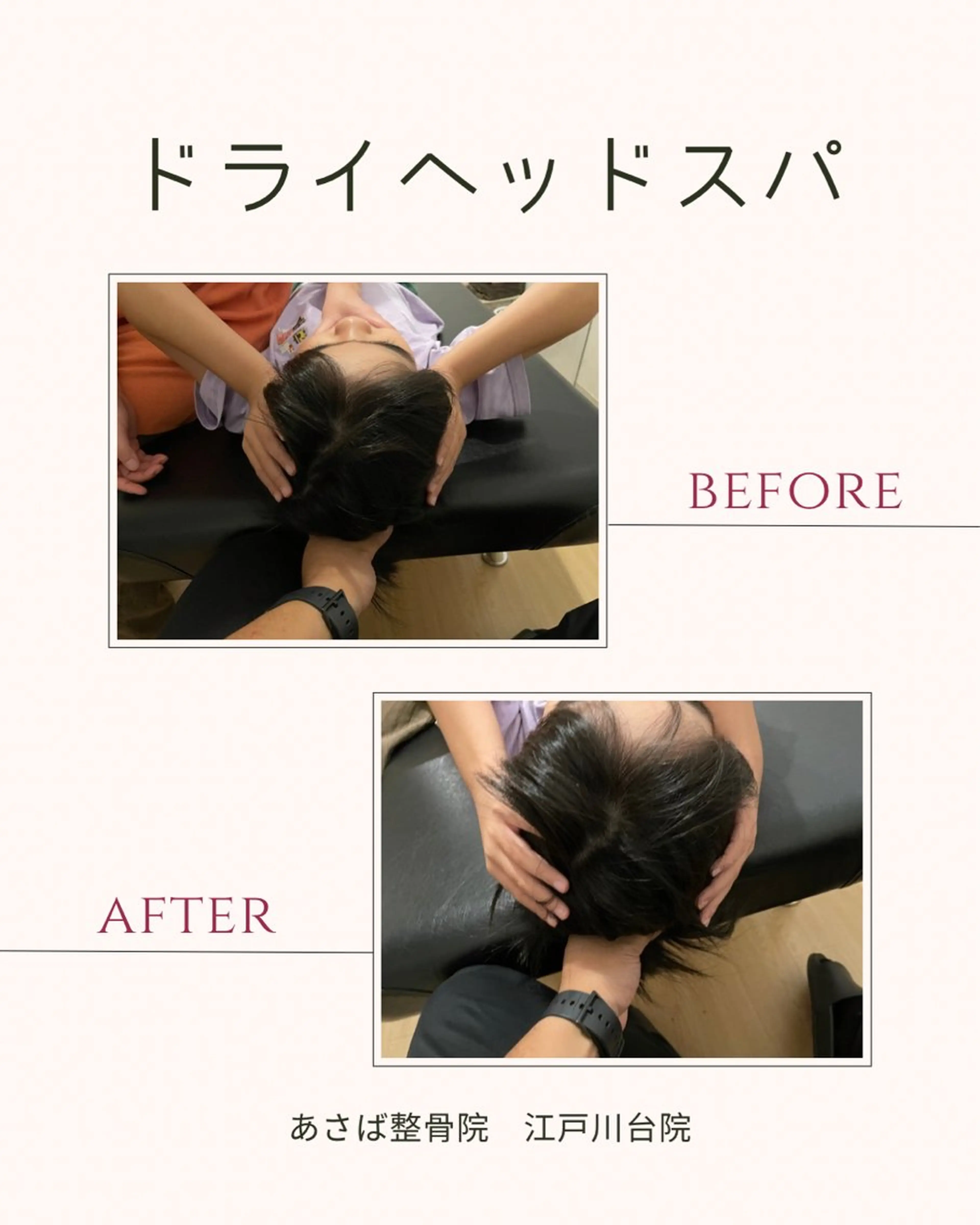 【小顔矯正あり😊】ドライヘッドスパ🧖30分🛌自律神経調整と小顔矯正で根本原因にアプローチ‼️の写真