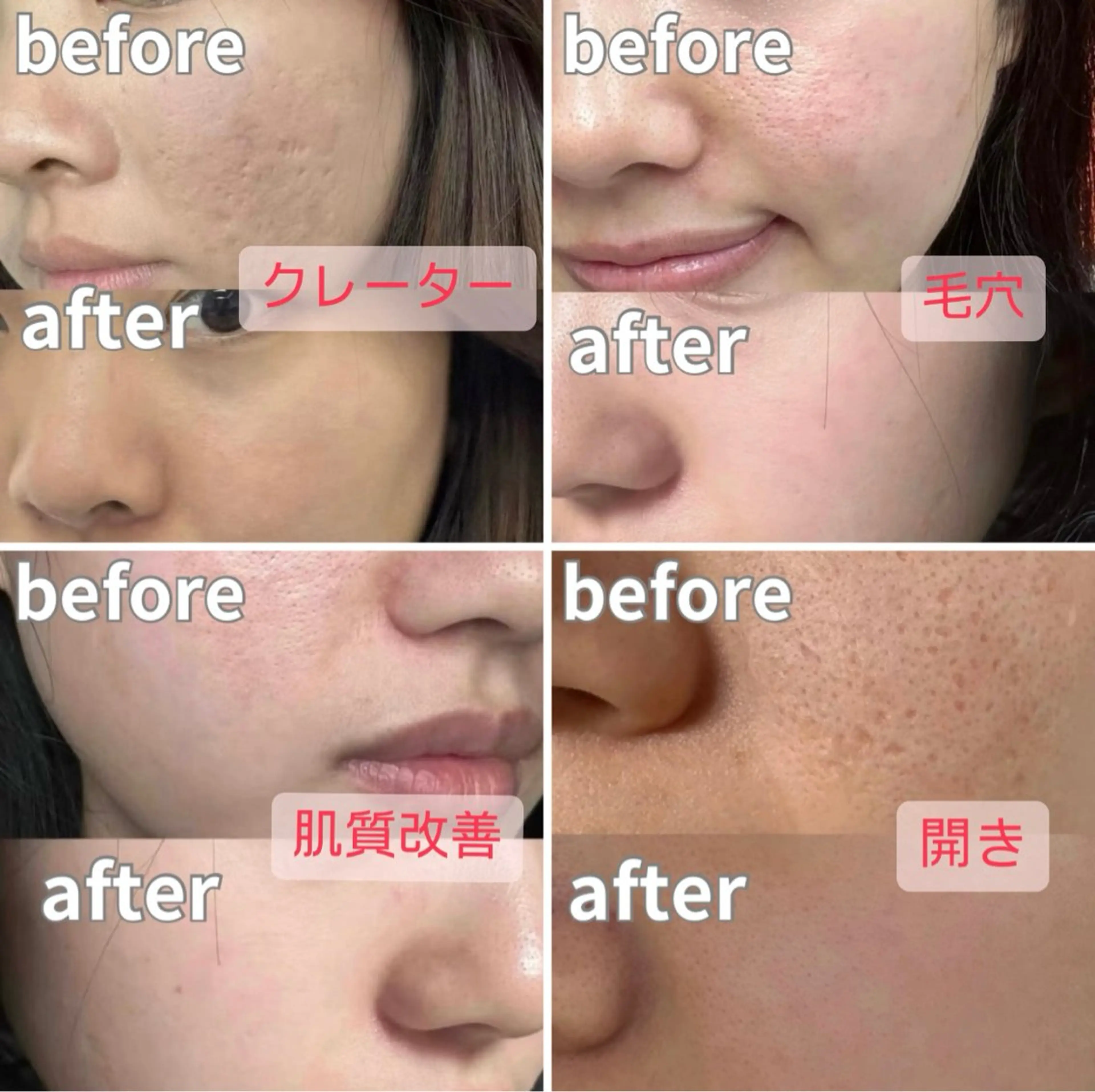 ショート エステ リラク 愛維美水光美肌専門店所属・愛維美水光美肌専門店 メンズレディースokのエステ・リラクイメージ