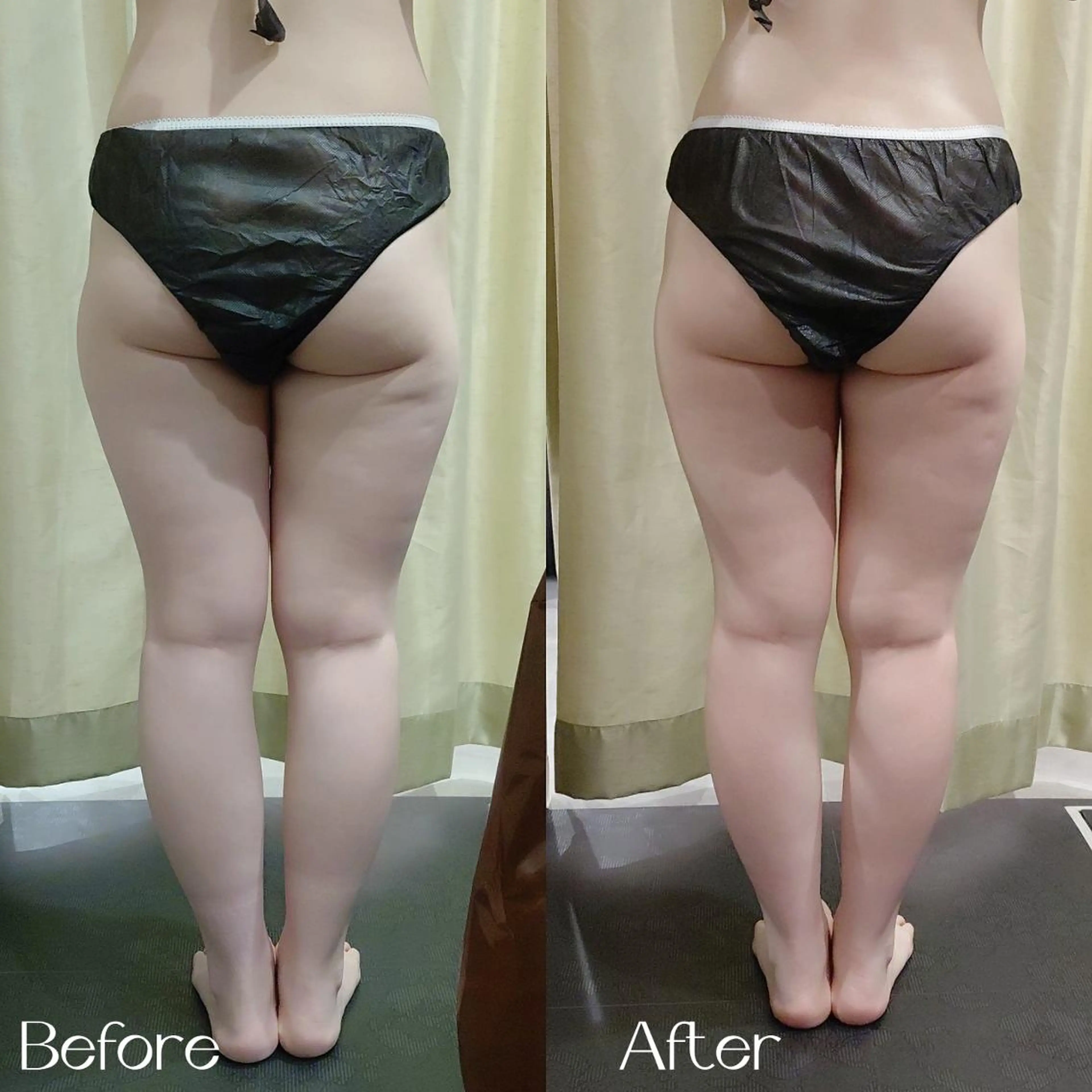 エステ リラク MyFairLady miuのエステ・リラクイメージ