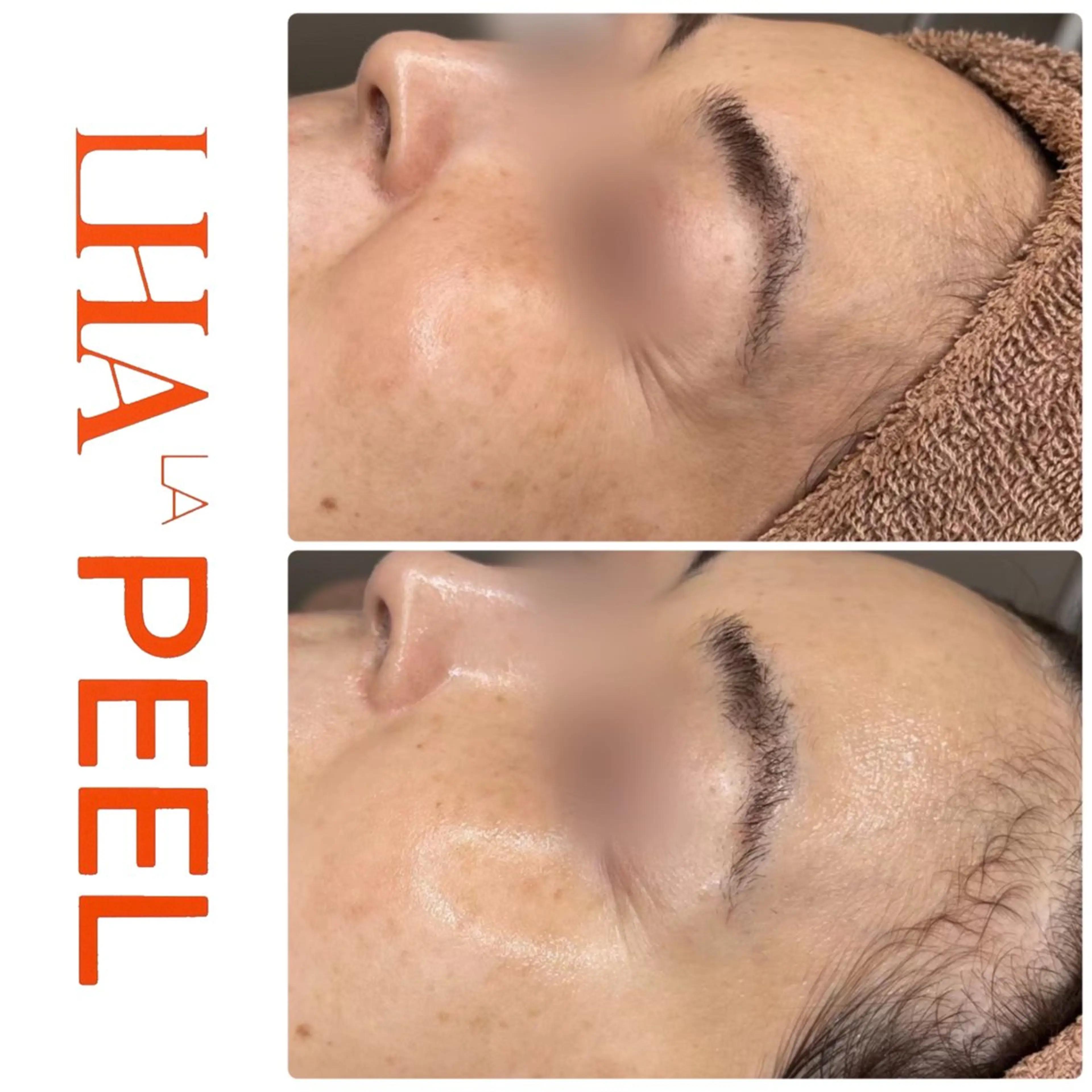 ハーブピーリング専門 BIOEL横浜のエステ・リラクイメージ