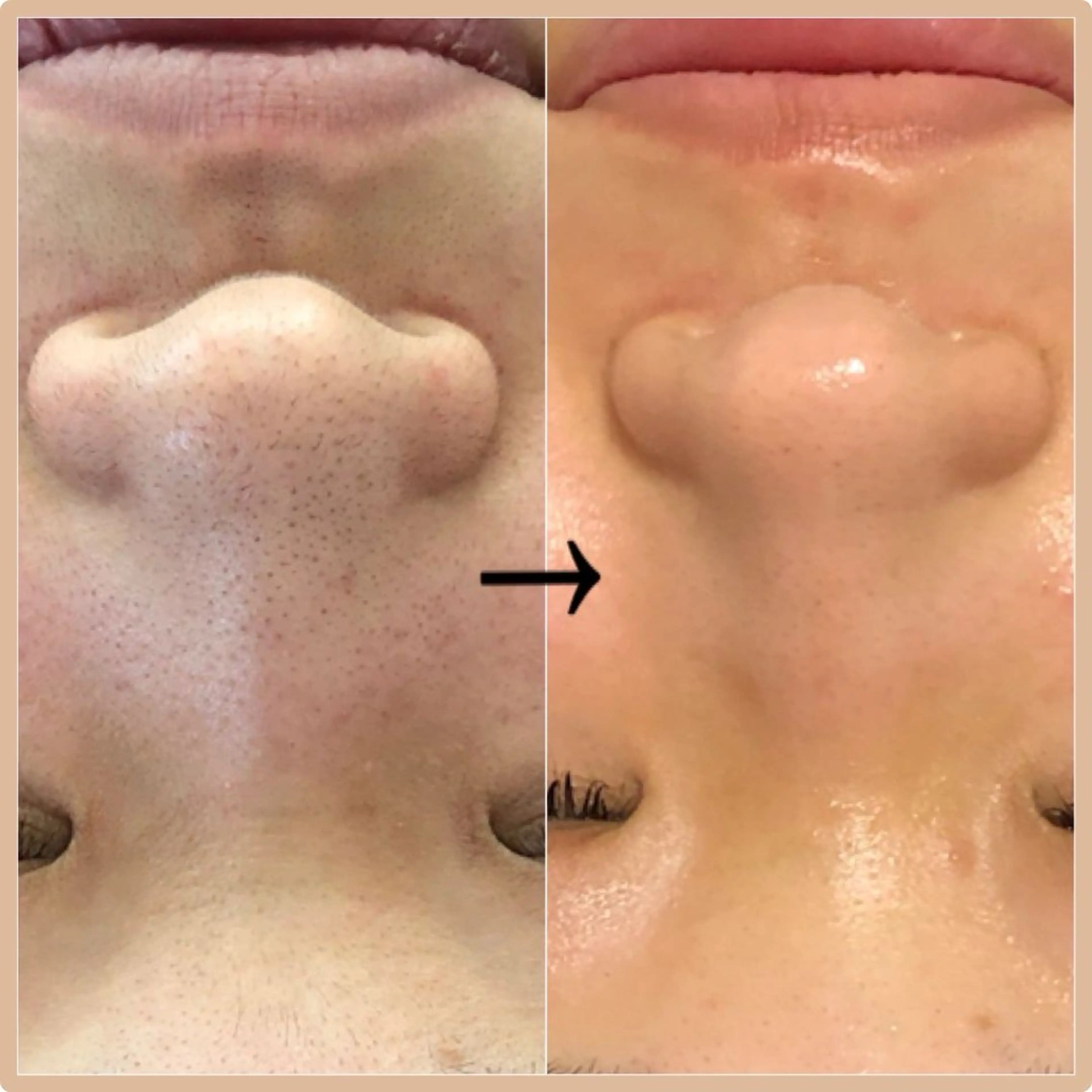 美容整体サロン Melalinoのエステ・リラクイメージ