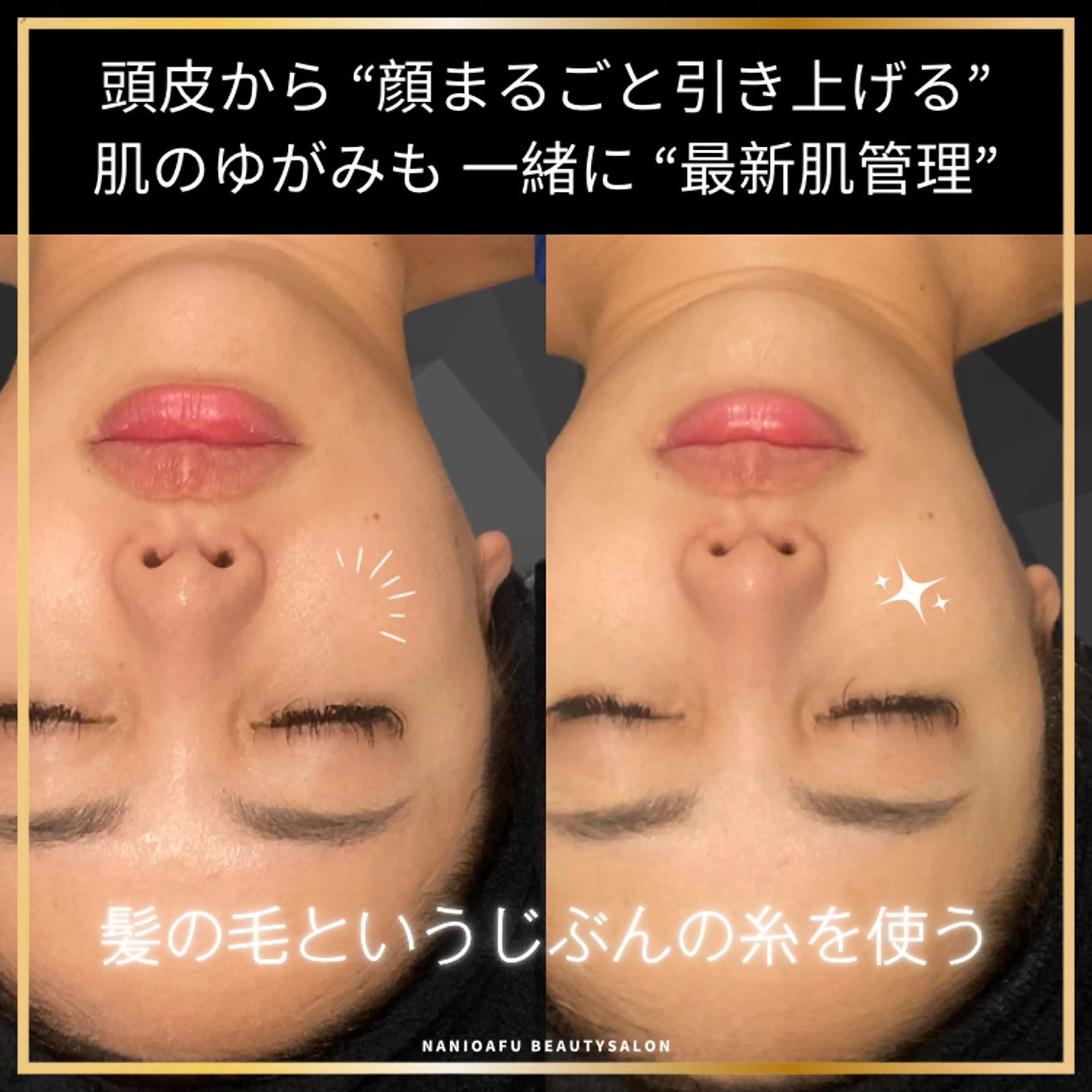 その他 NANI OAFU所属・NANIOAFU [なんば店］のエステ・リラクイメージ