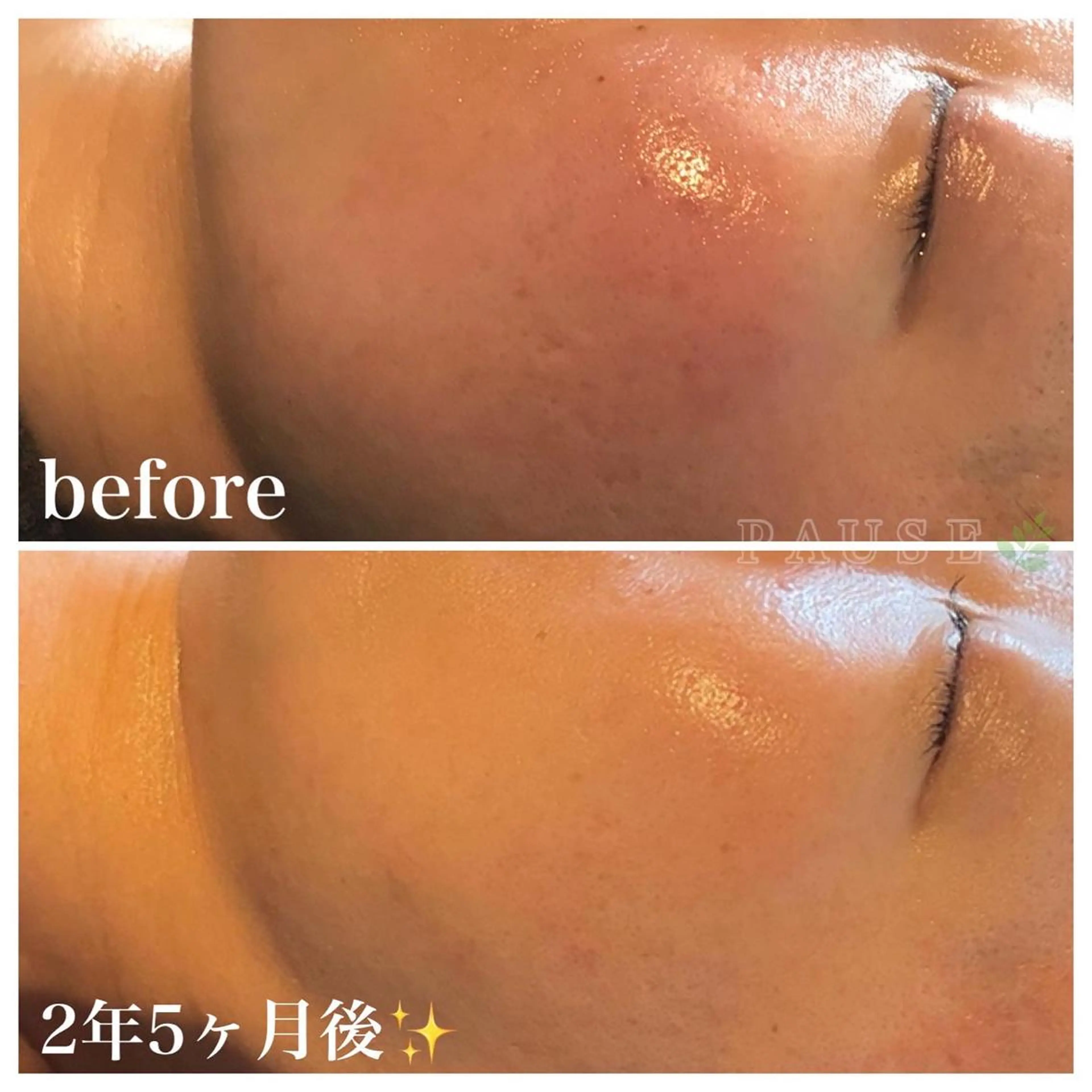 エステ 浜野 恵美のエステ・リラクイメージ