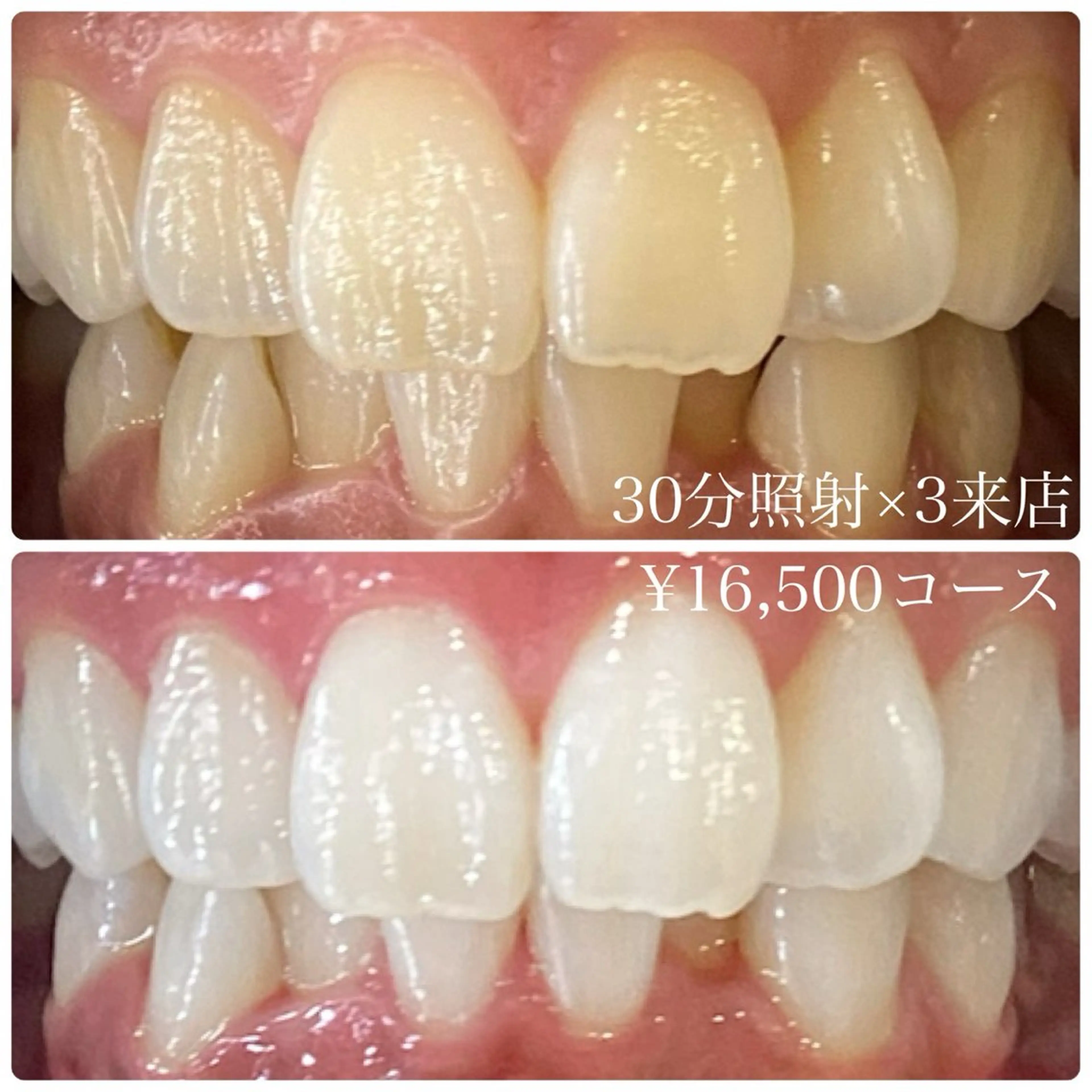 PLATINUM Beauty 横浜店所属・ホワイトニングルーム 横浜店のその他イメージ