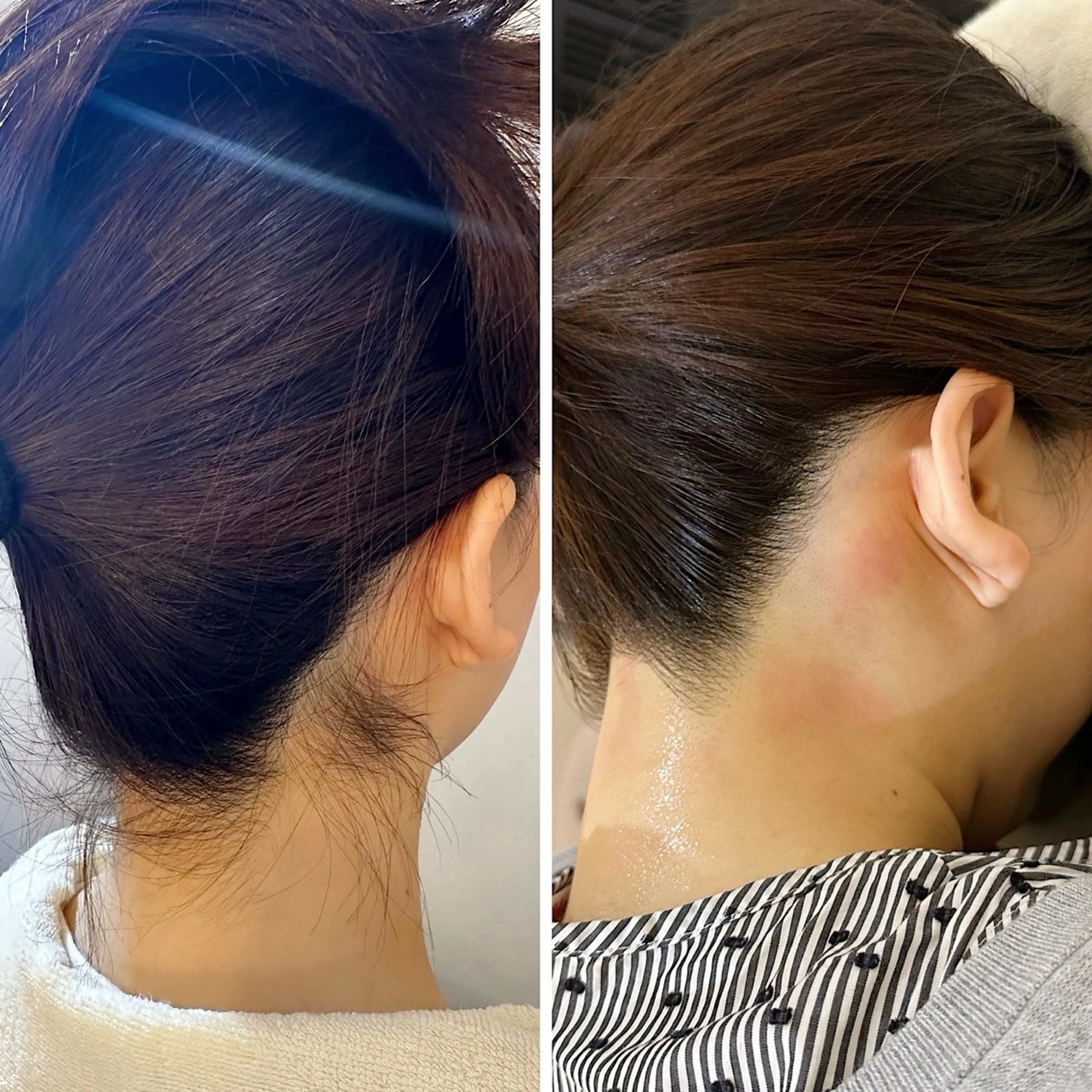 脱毛 うなじ脱毛/美肌脱毛 LABELのエステ・リラクイメージ