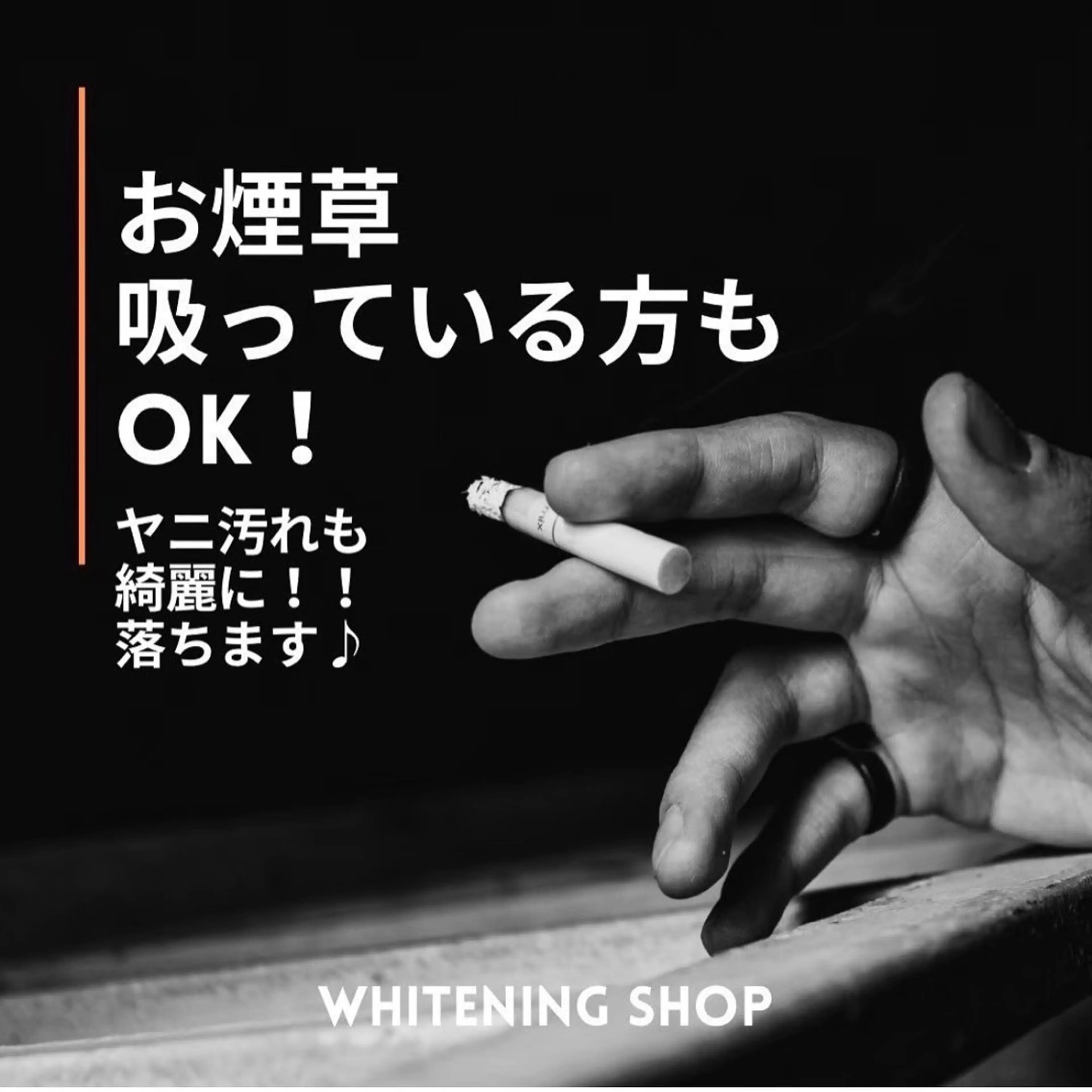 ホワイトニングショップ伊丹店所属・ホワイトニング ショップ伊丹店のその他イメージ