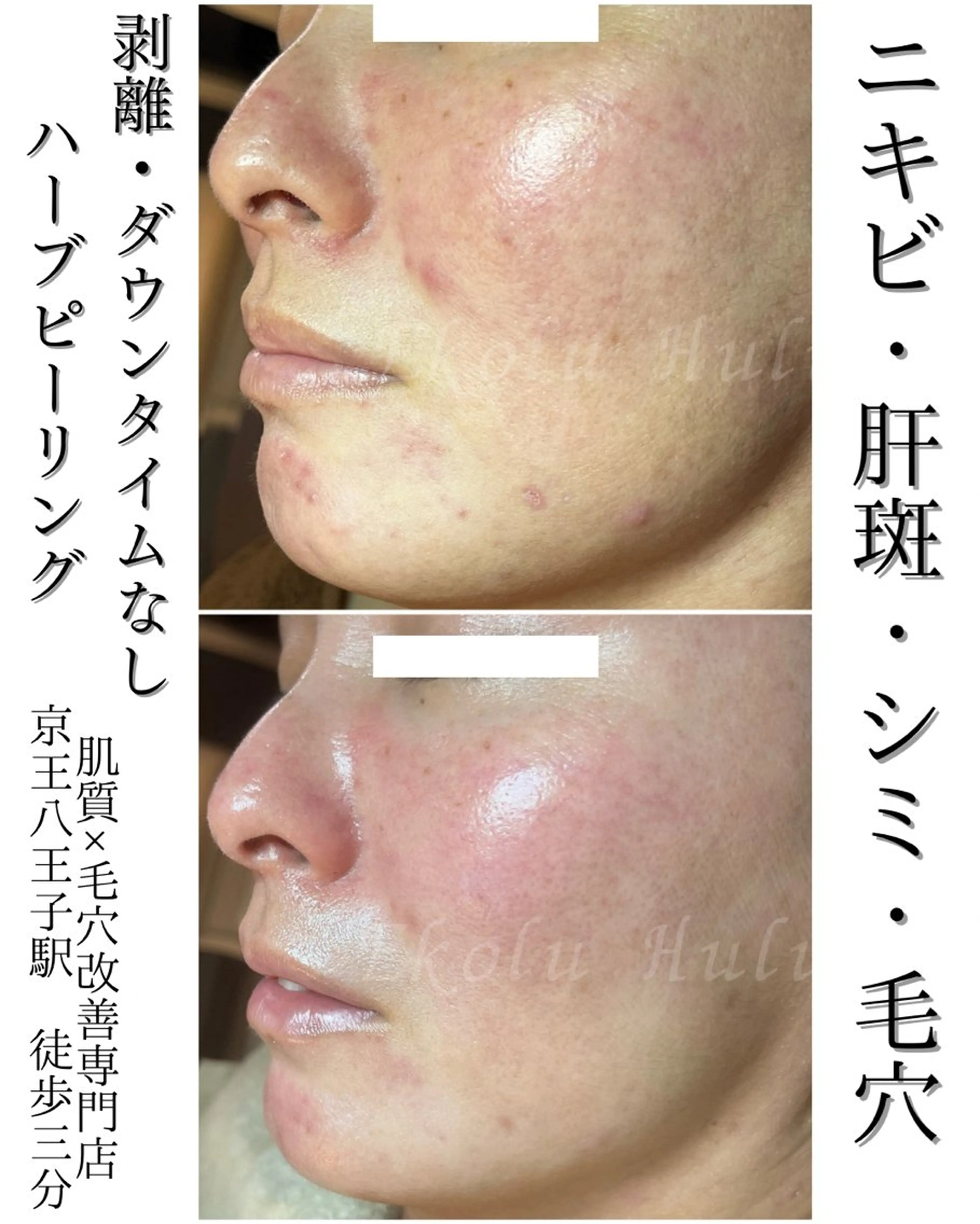 Ekolu Hulu所属・Ekolu Hulu エコル フルのエステ・リラクイメージ