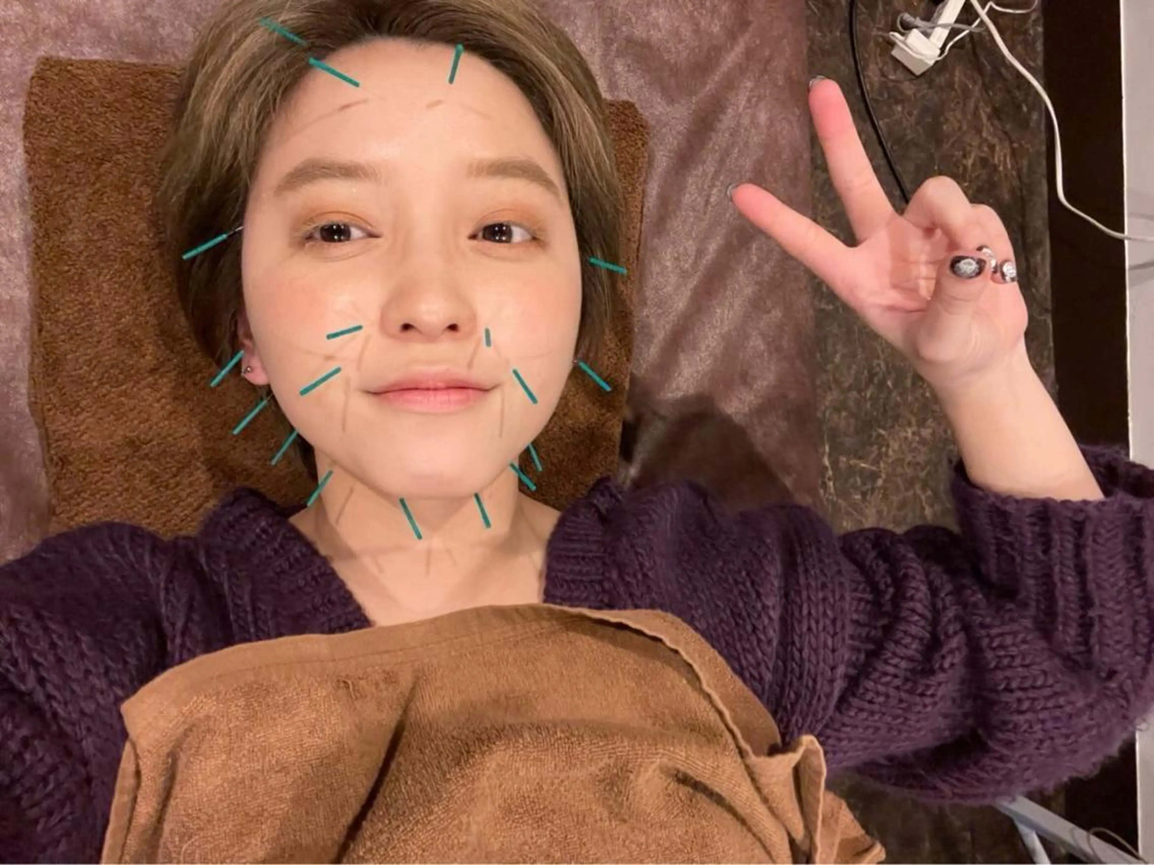 メンズ エステ リラク 美容鍼灸サロン LOMIHARIのエステ・リラクイメージ