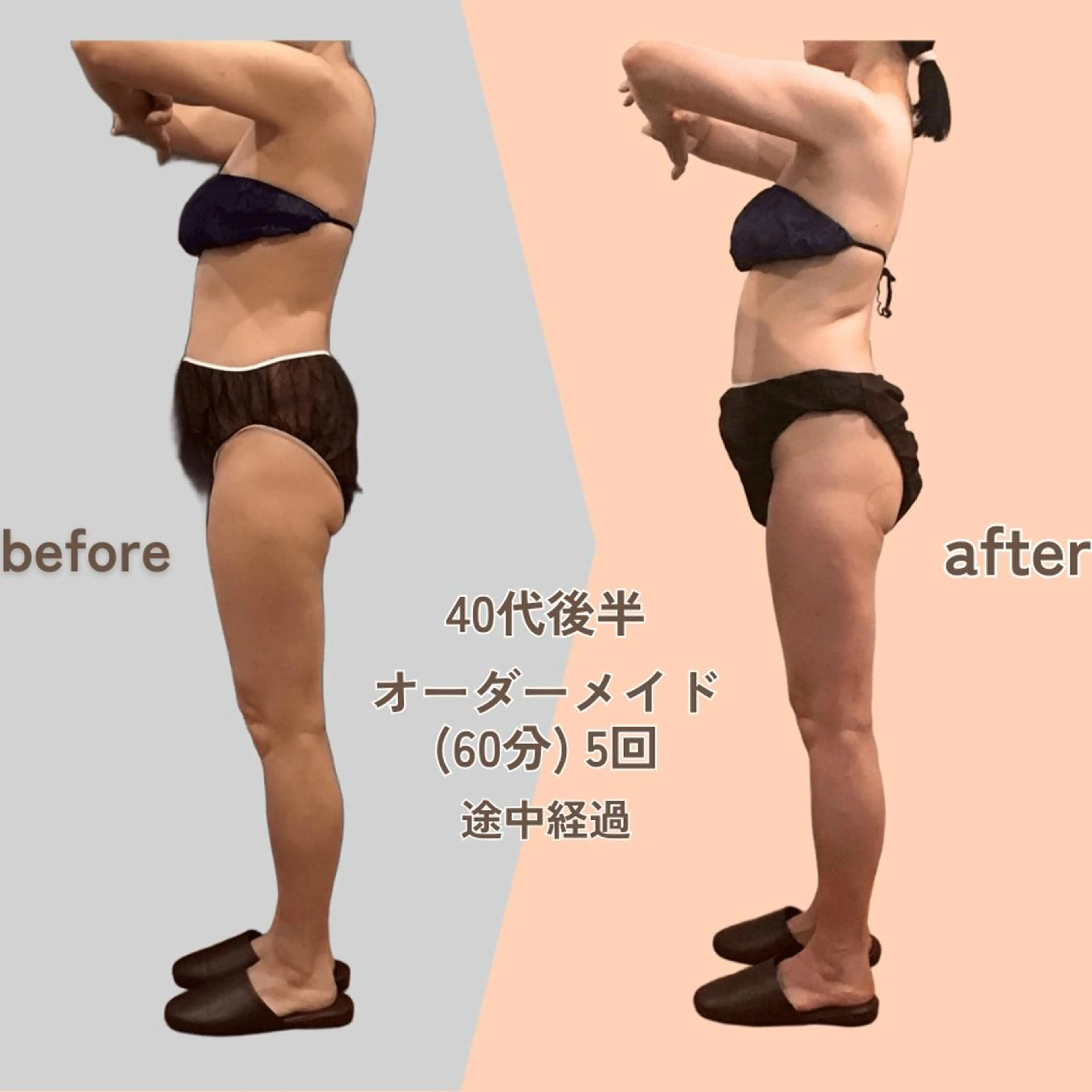 痩身エステ Julien麹町店のエステ・リラクイメージ