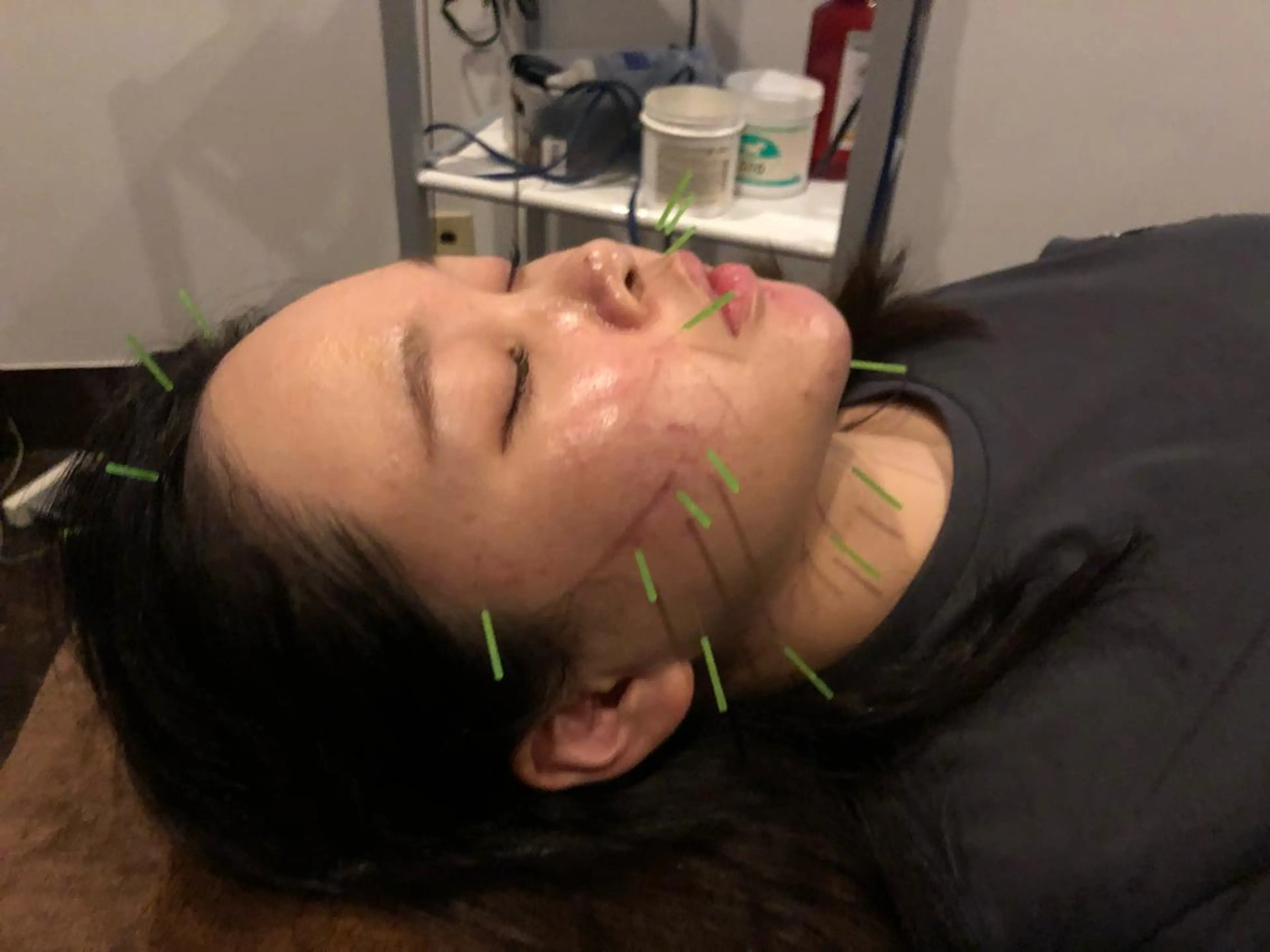 メンズ エステ リラク 美容鍼灸サロン LOMIHARIのエステ・リラクイメージ