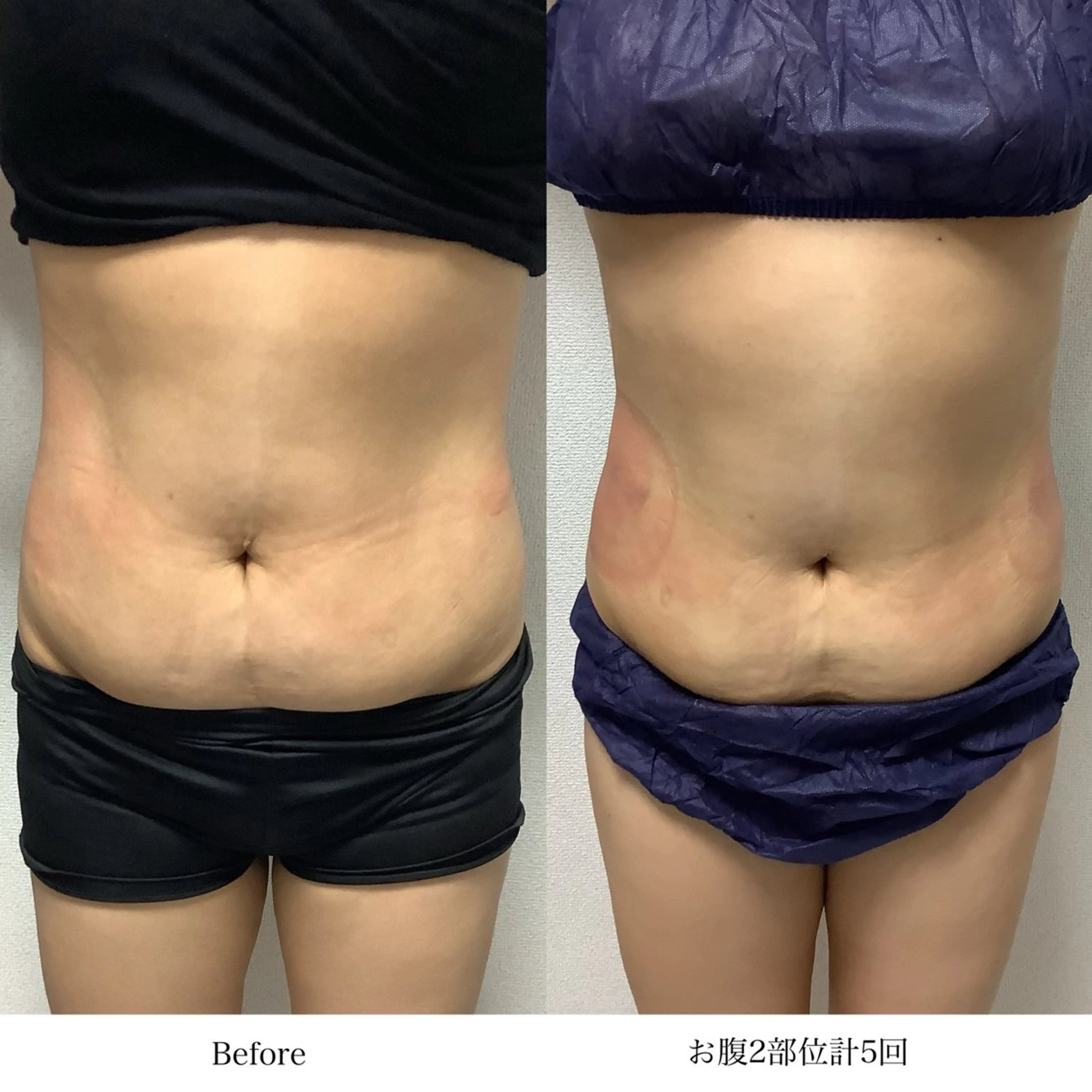 冷却専門店 SLARIのエステ・リラクイメージ