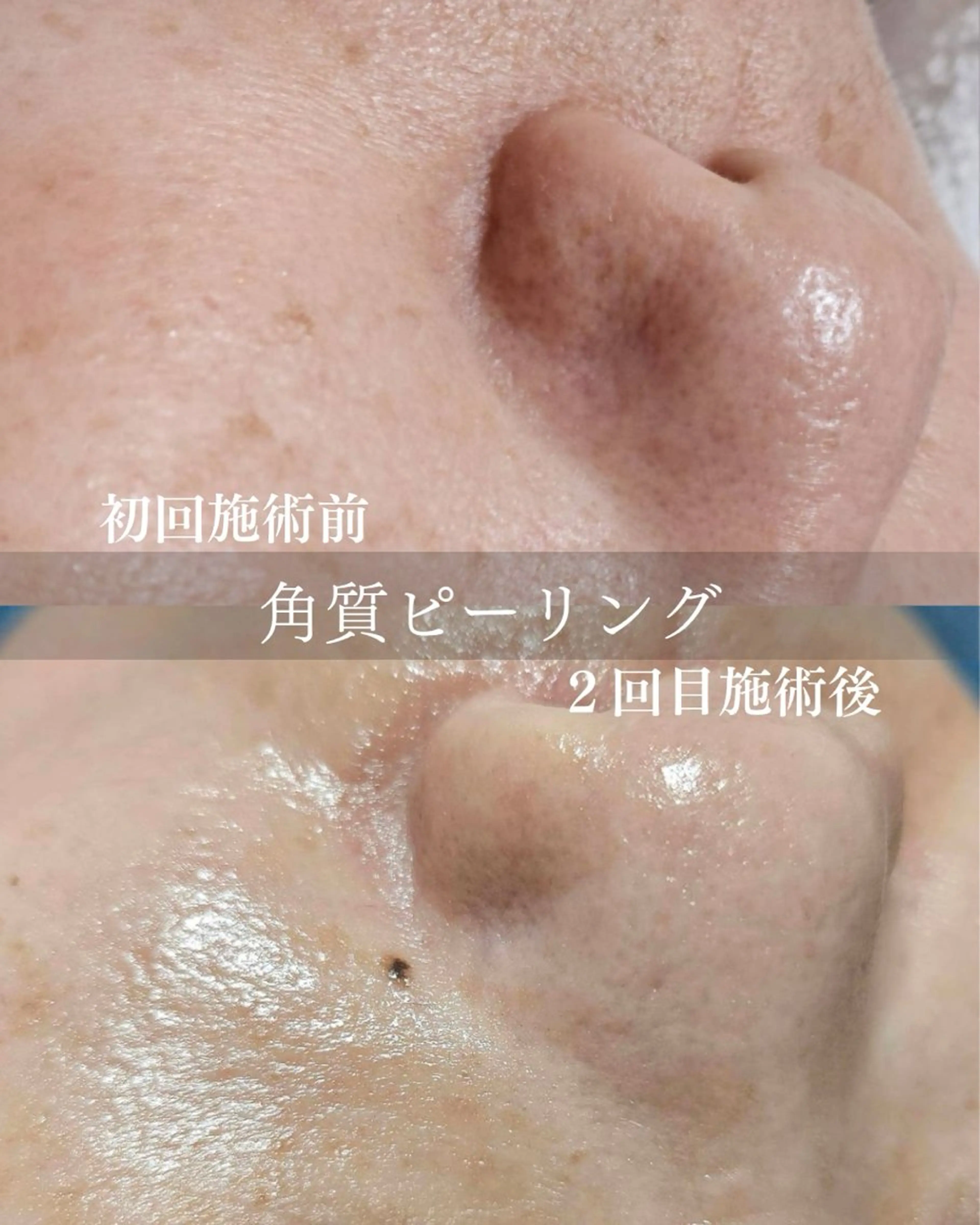 ESPOIR 鈴木七海のエステ・リラクイメージ