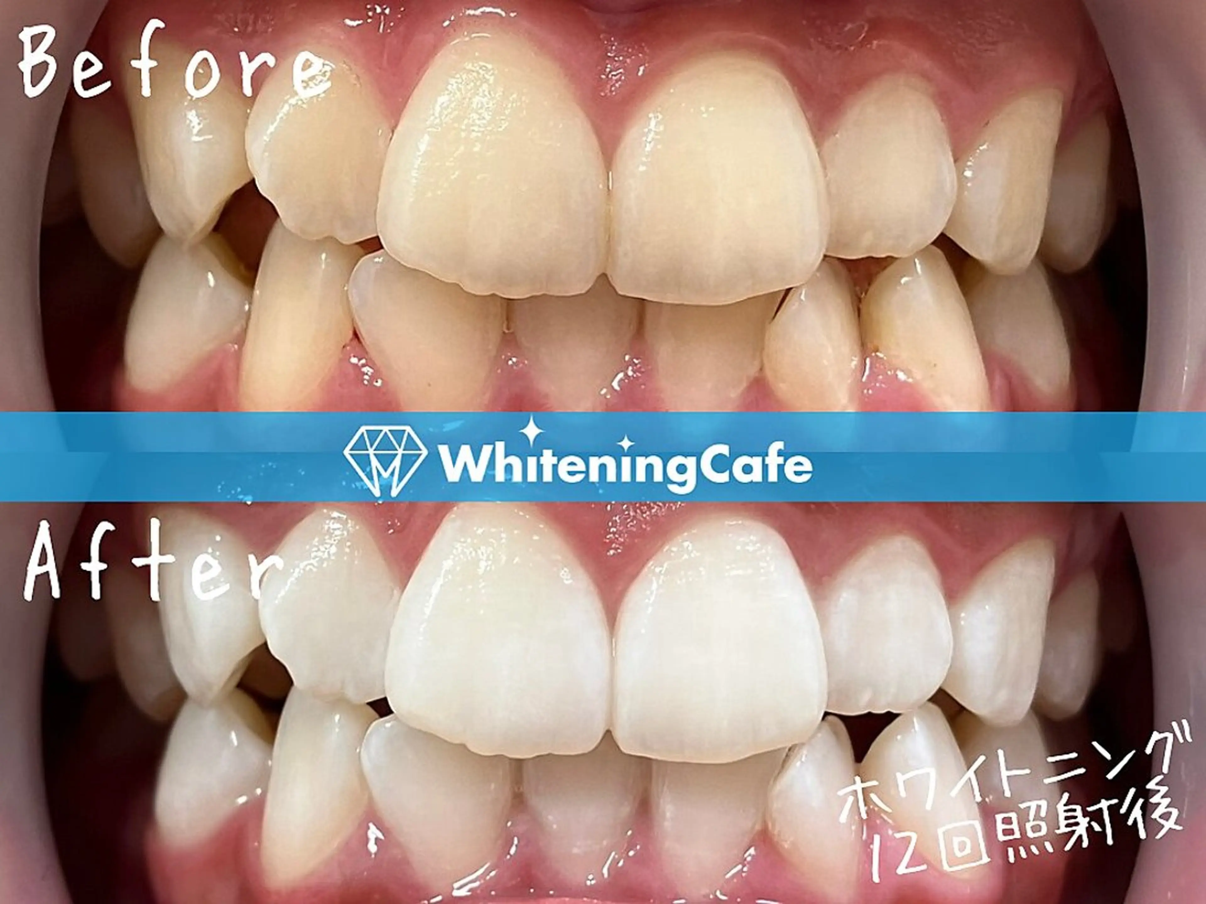 ホワイトニングカフェ原宿店所属・ホワイトニングカフェ 原宿店のエステ・リラクイメージ