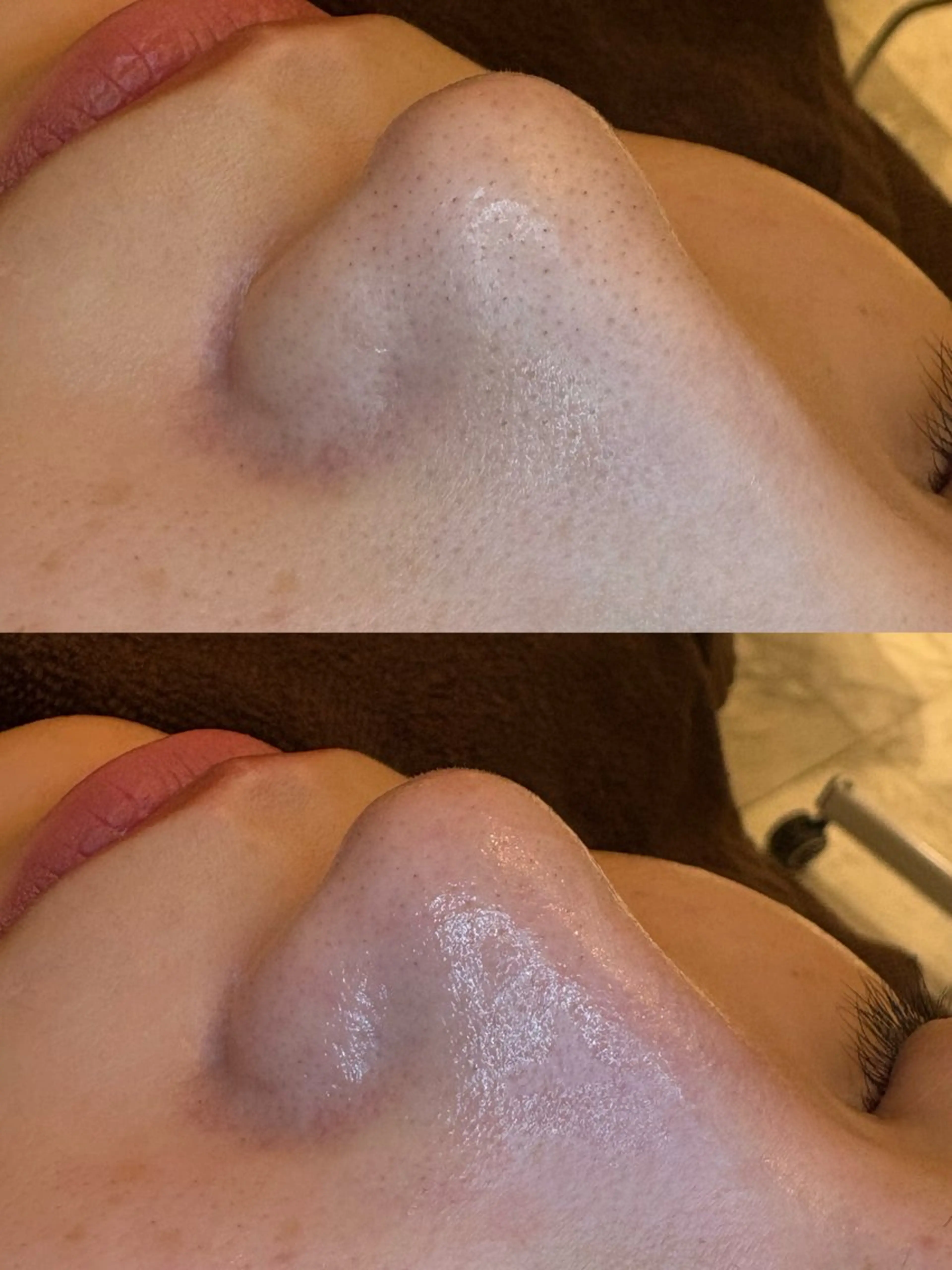 エステ EARTH coiffure beaute 新潟紫竹山店所属・🤍アベシュリ /フェイシャル🤍のエステ・リラクイメージ